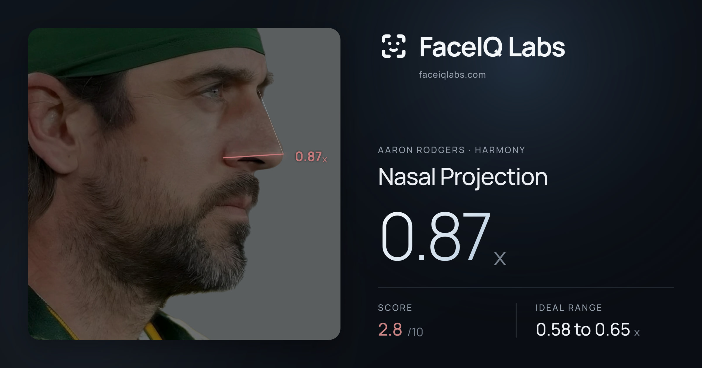 Aaron Rodgers Nasal Projection: 0.87x, drawn on the photo