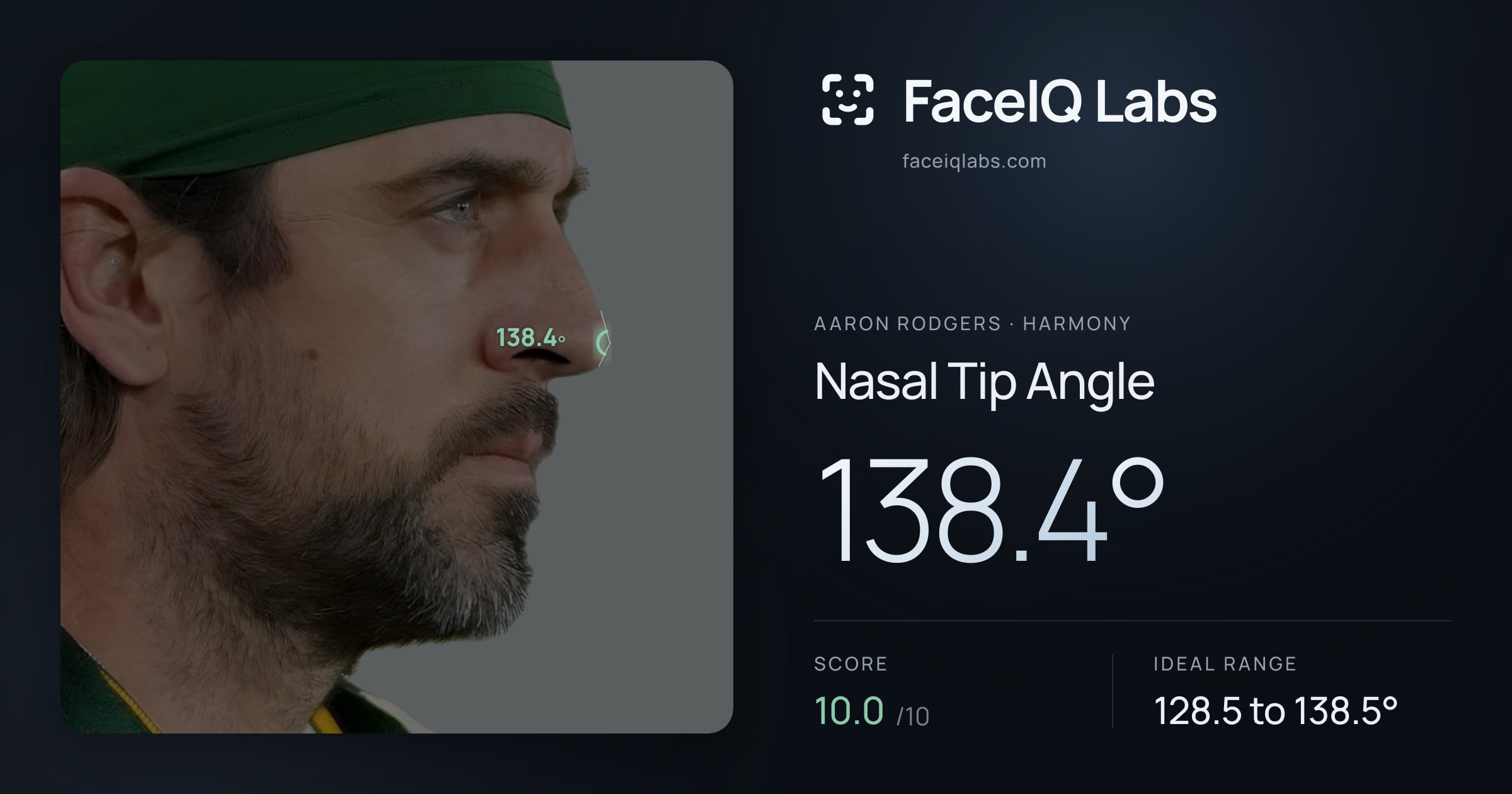 Aaron Rodgers Nasal Tip Angle: 138.4°, drawn on the photo