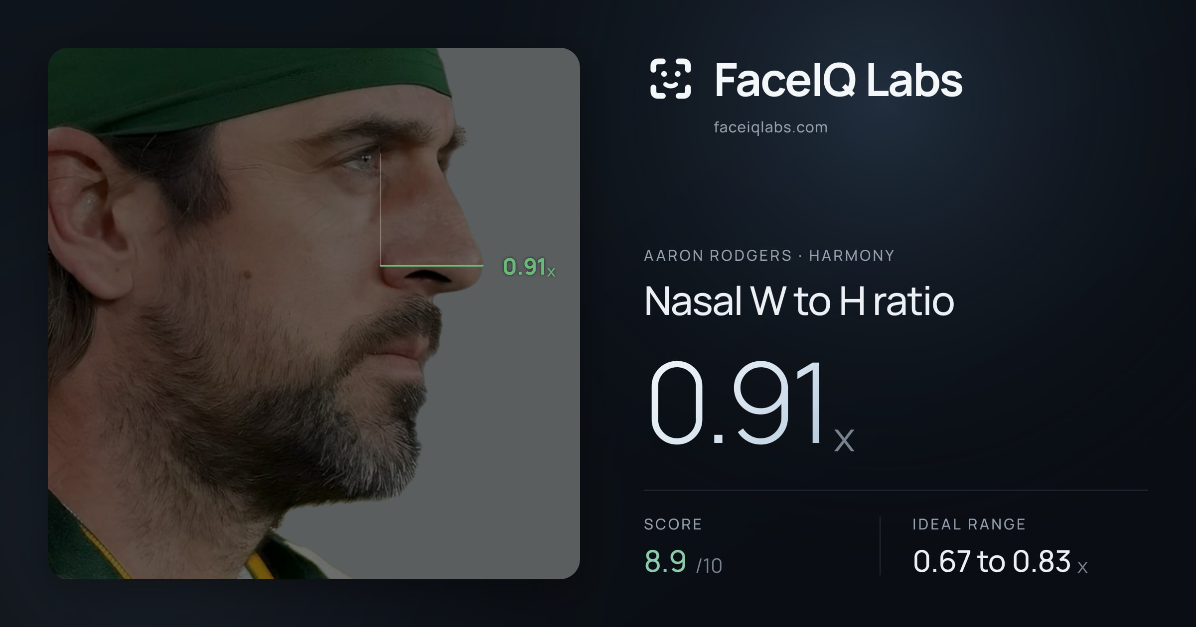 Aaron Rodgers Nasal W to H ratio: 0.91x, drawn on the photo