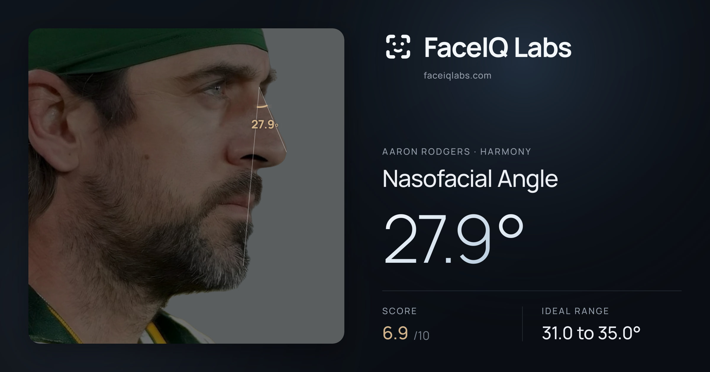 Aaron Rodgers Nasofacial Angle: 27.9°, drawn on the photo