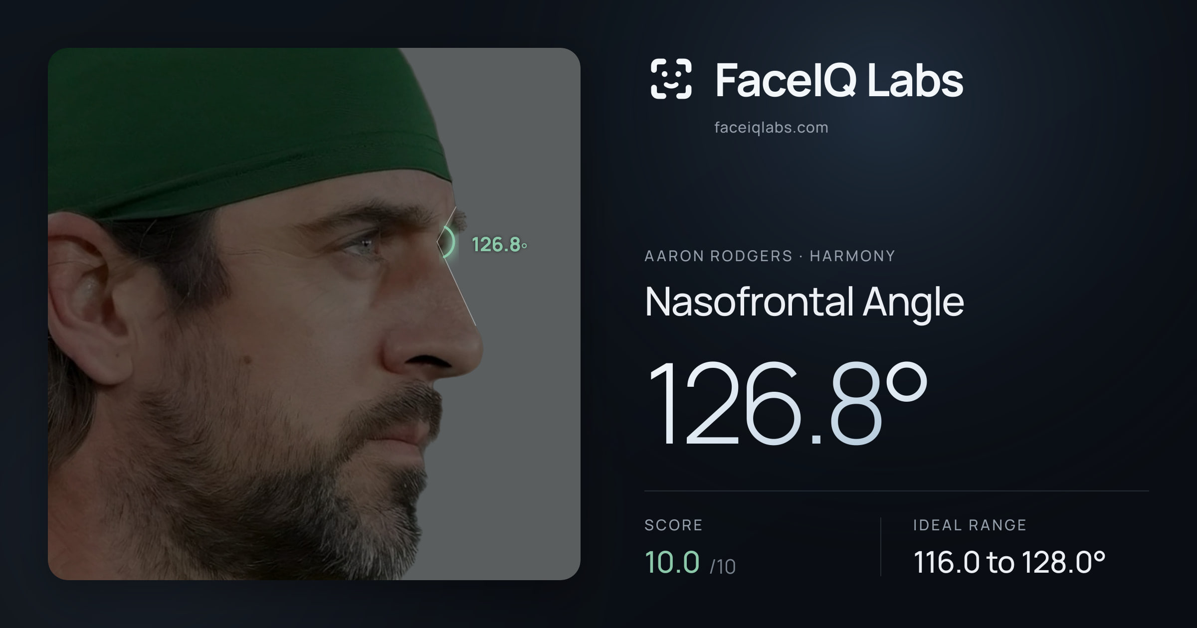 Aaron Rodgers Nasofrontal Angle: 126.8°, drawn on the photo
