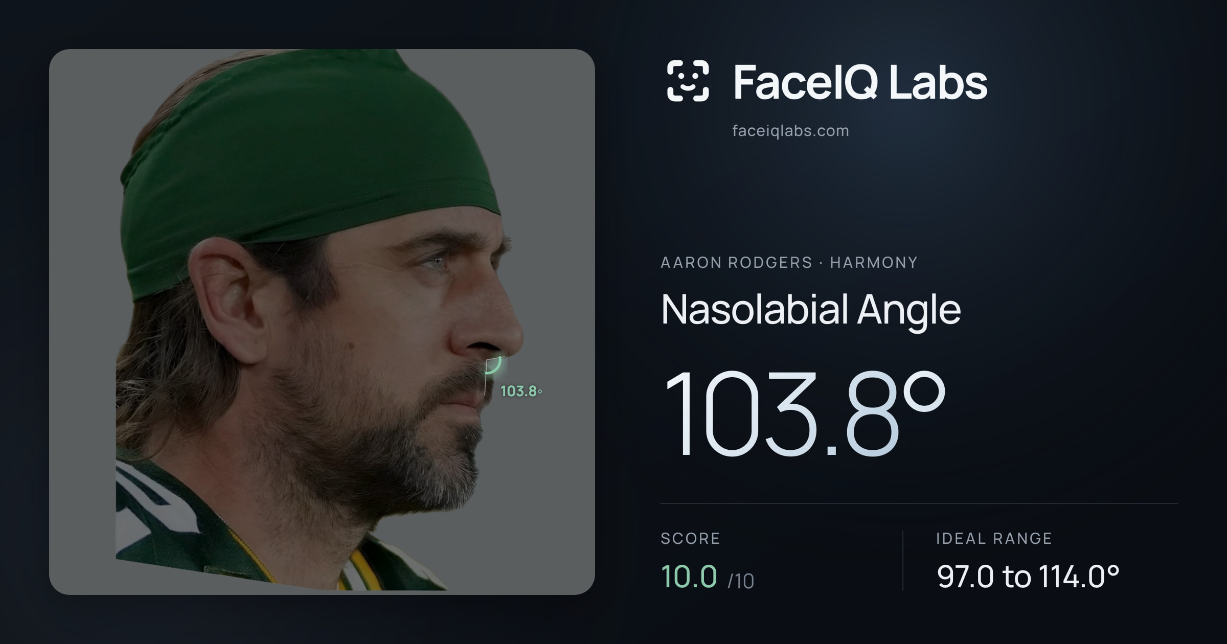 Aaron Rodgers Nasolabial Angle: 103.8°, drawn on the photo