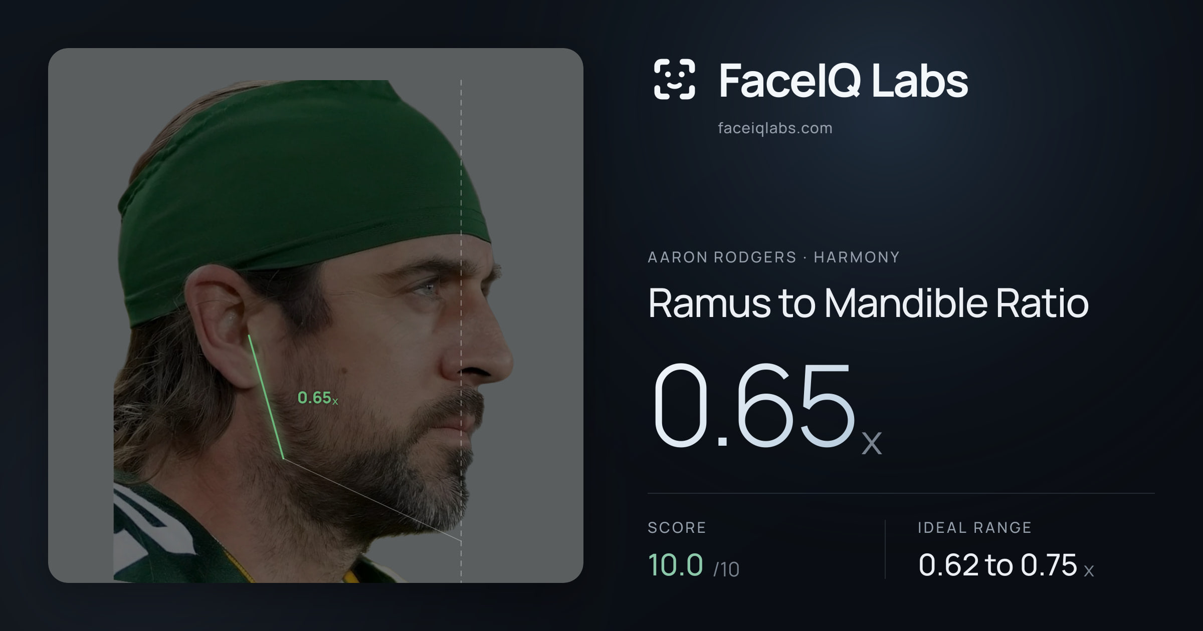 Aaron Rodgers Ramus to Mandible Ratio: 0.65x, drawn on the photo