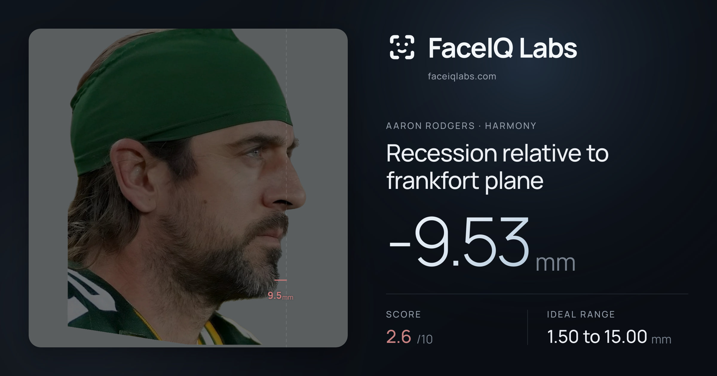 Aaron Rodgers Recession relative to frankfort plane: -9.53mm, drawn on the photo