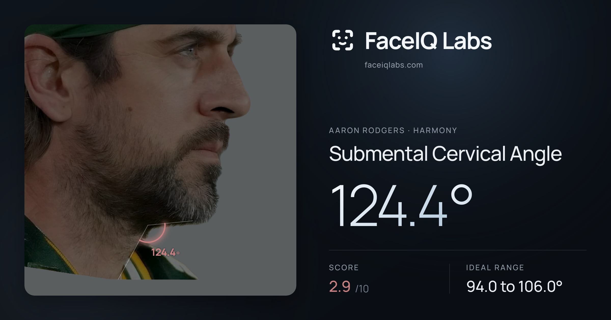 Aaron Rodgers Submental Cervical Angle: 124.4°, drawn on the photo