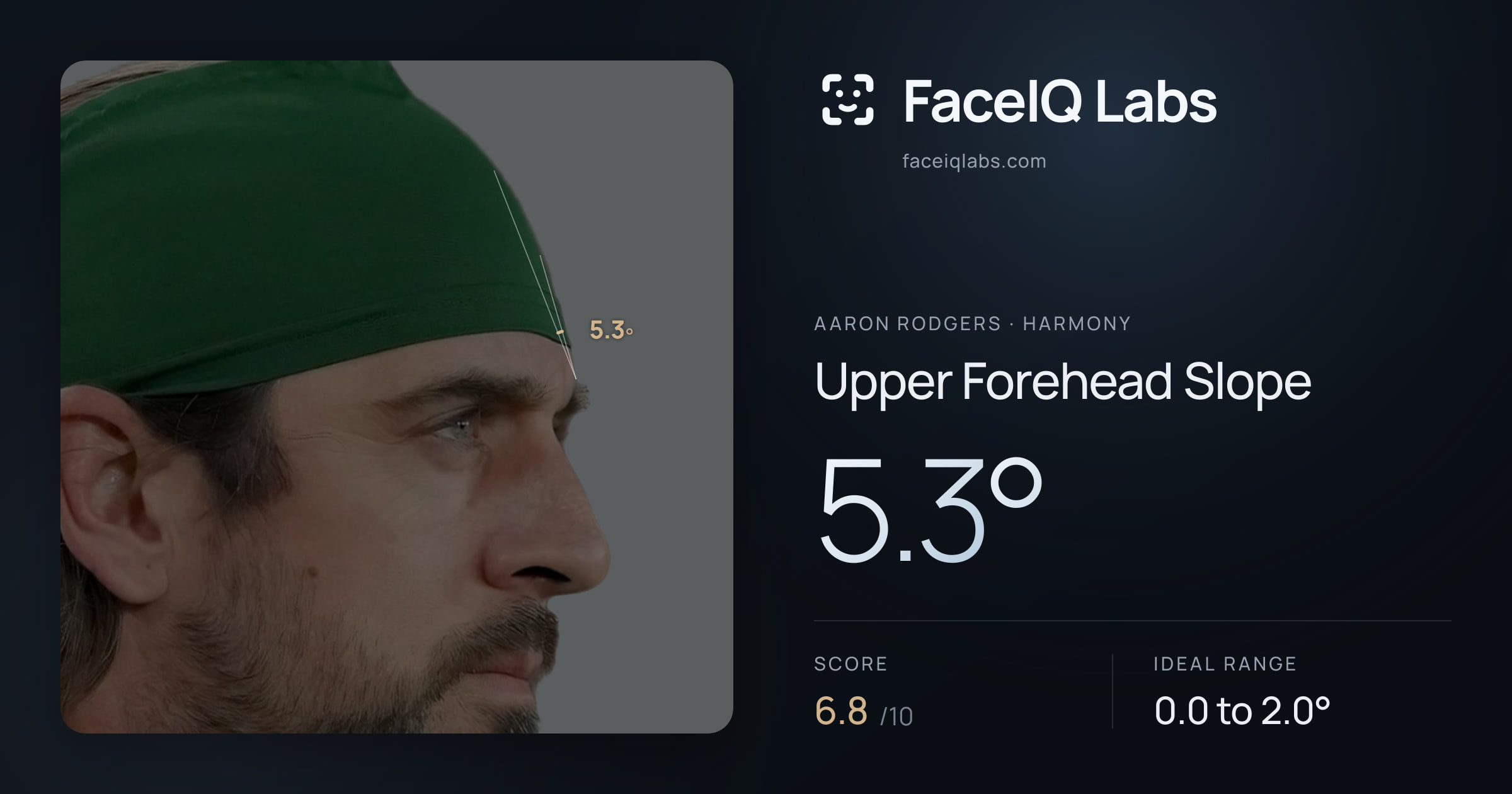 Aaron Rodgers Upper Forehead Slope: 5.3°, drawn on the photo