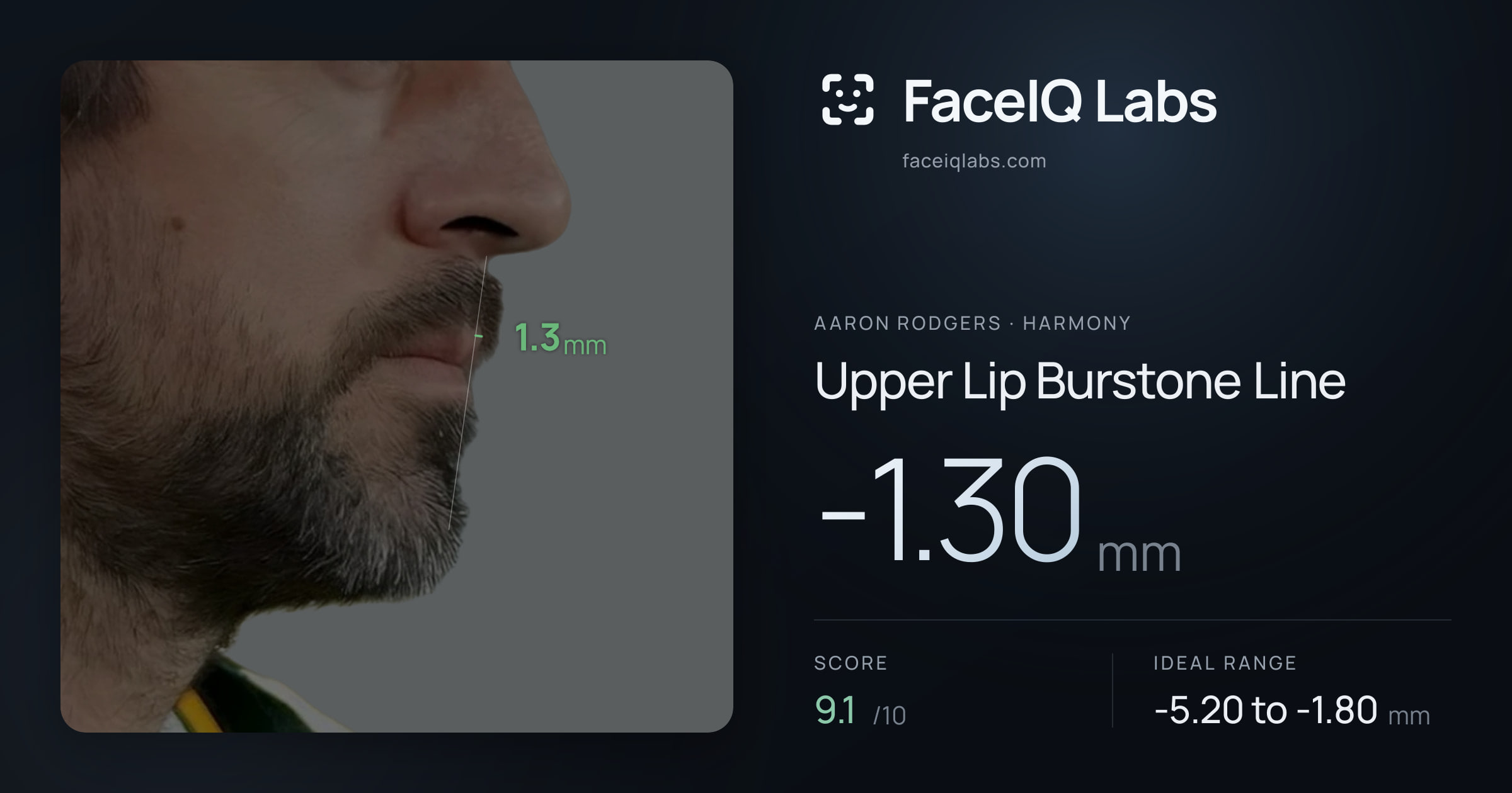 Aaron Rodgers Upper Lip Burstone Line: -1.30mm, drawn on the photo