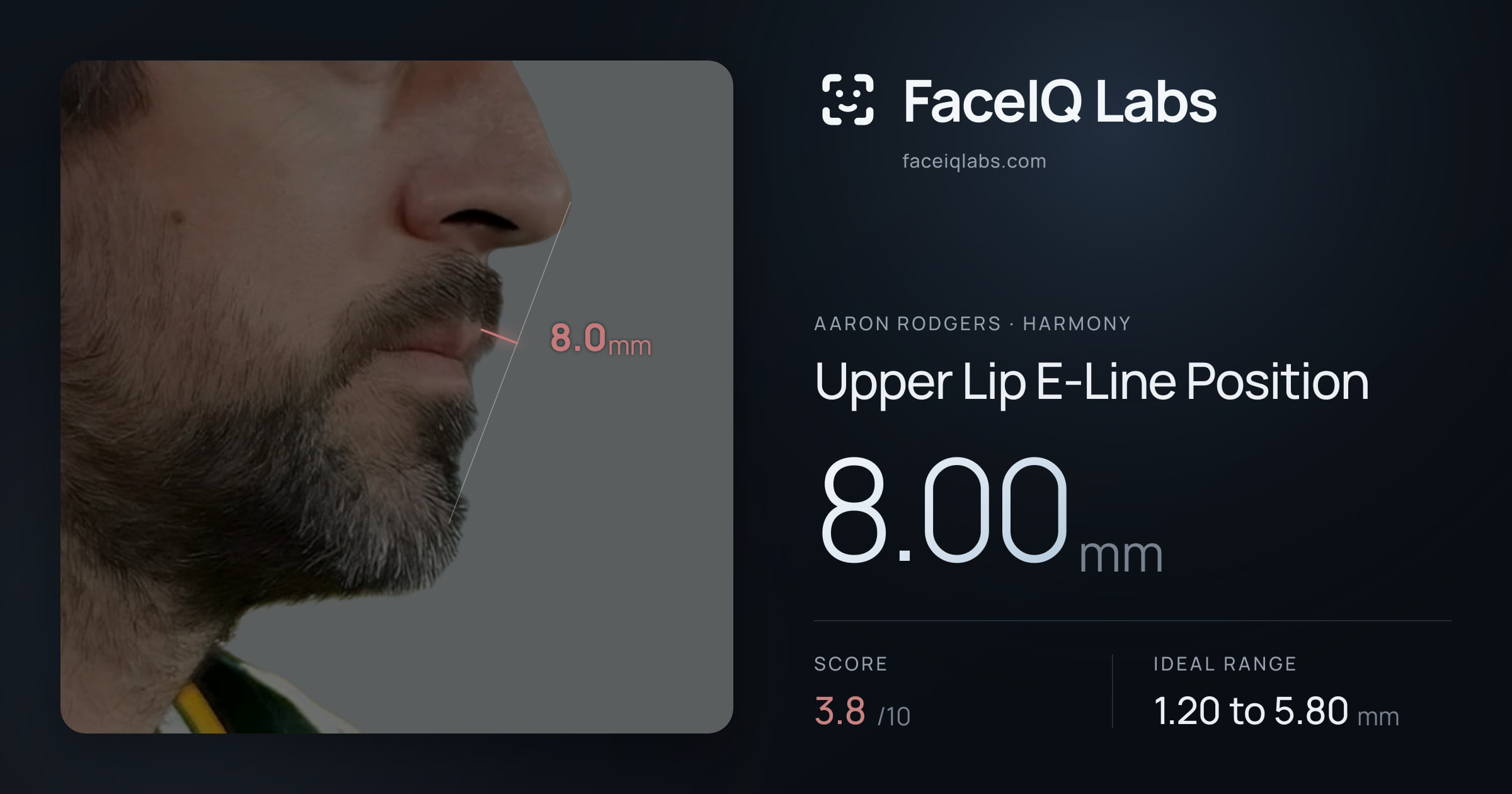 Aaron Rodgers Upper Lip E-Line Position: 8.00mm, drawn on the photo