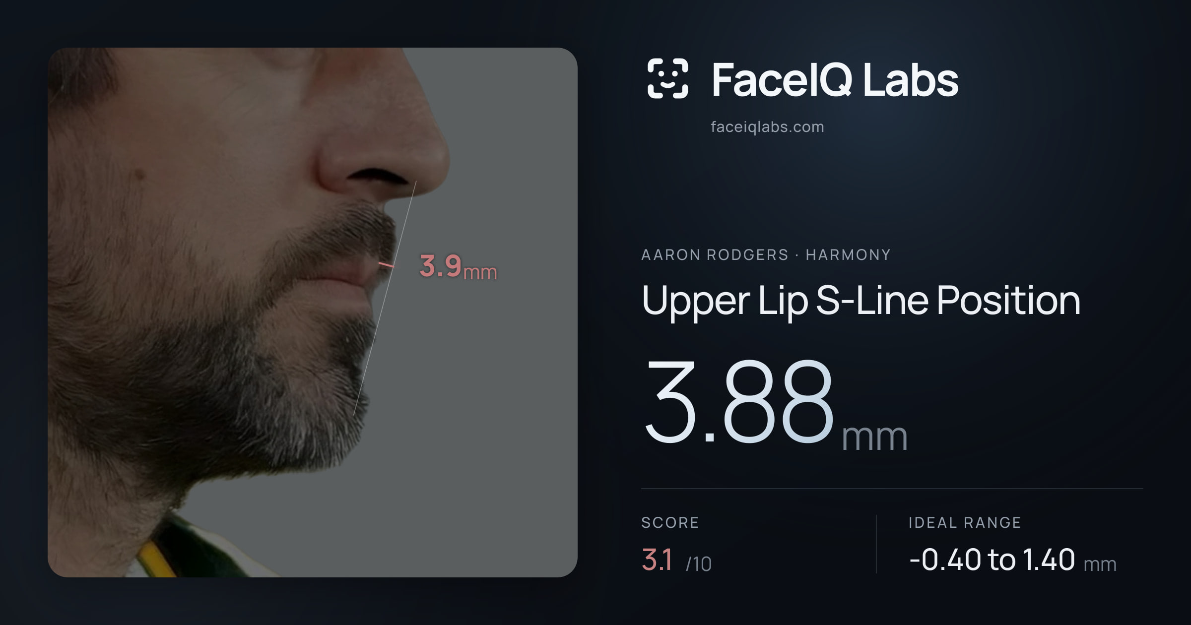 Aaron Rodgers Upper Lip S-Line Position: 3.88mm, drawn on the photo