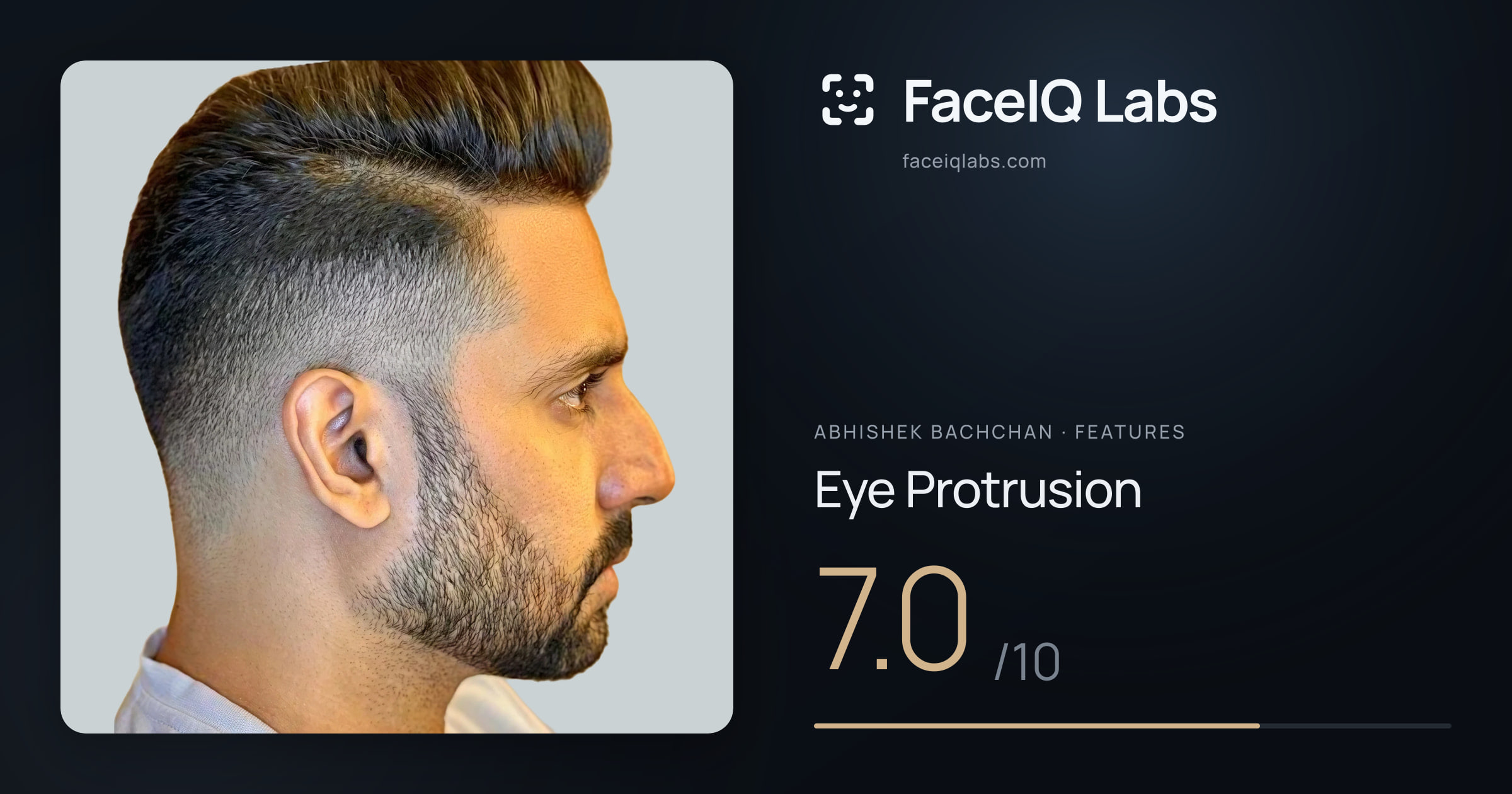 Abhishek Bachchan Eye Protrusion: 7.0/10, drawn on the photo