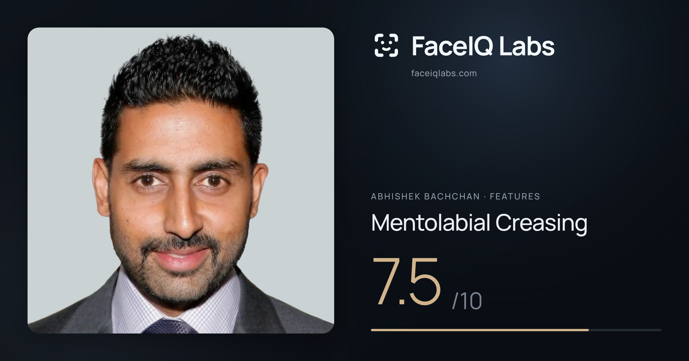 Abhishek Bachchan Mentolabial Creasing: 7.5/10, drawn on the photo