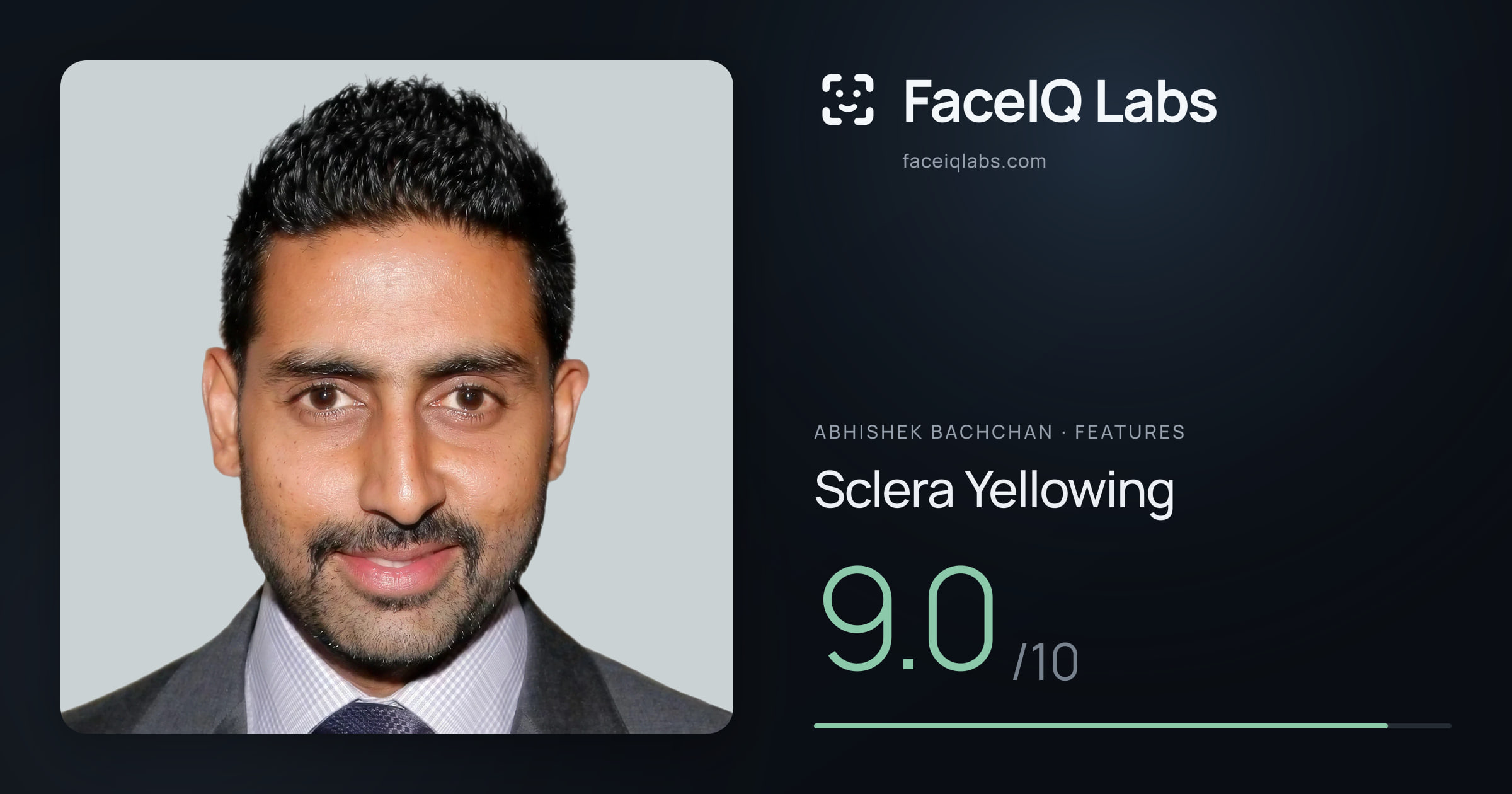 Abhishek Bachchan Sclera Yellowing: 9.0/10, drawn on the photo