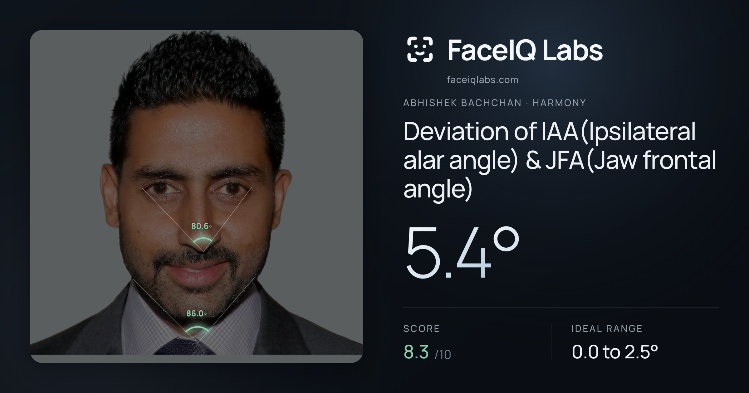 Abhishek Bachchan Deviation of IAA(Ipsilateral alar angle) & JFA(Jaw frontal angle): 5.4°, drawn on the photo
