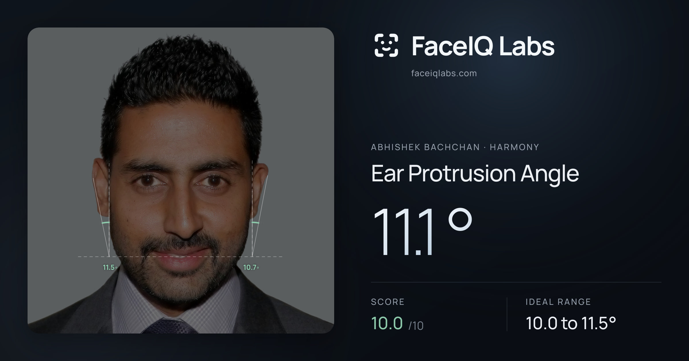 Abhishek Bachchan Ear Protrusion Angle: 11.1°, drawn on the photo