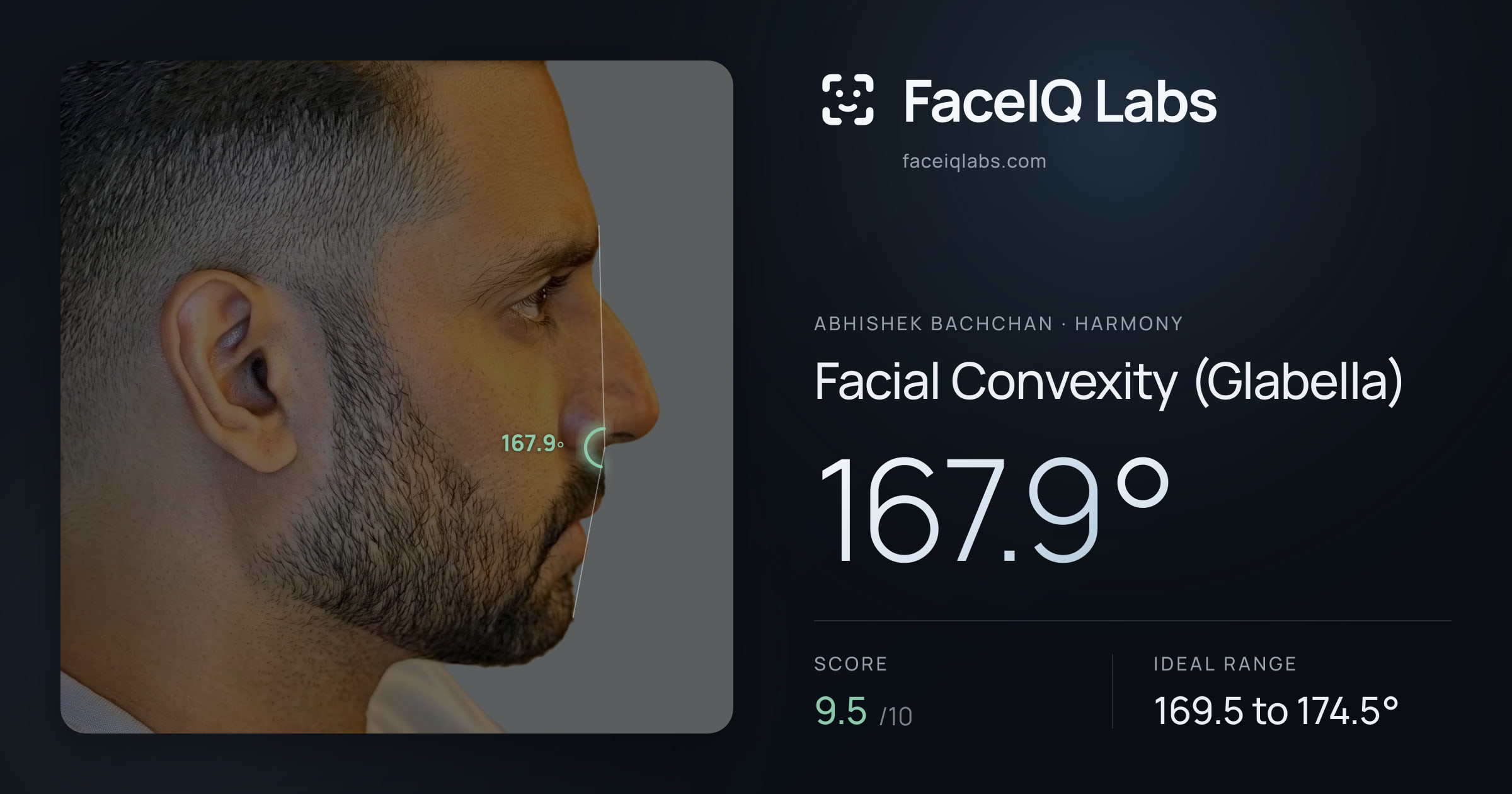 Abhishek Bachchan Facial Convexity (Glabella): 167.9°, drawn on the photo