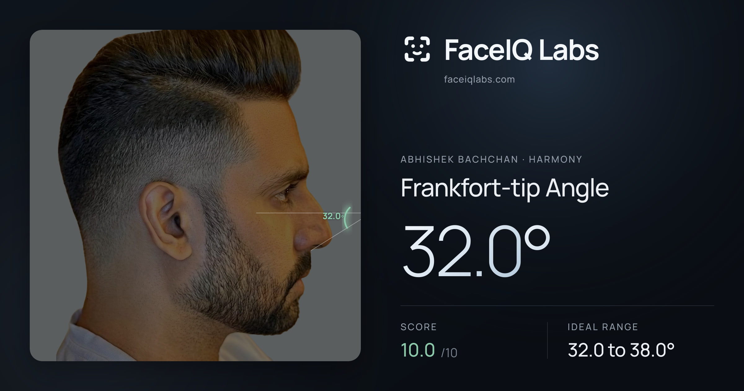 Abhishek Bachchan Frankfort-tip Angle: 32.0°, drawn on the photo