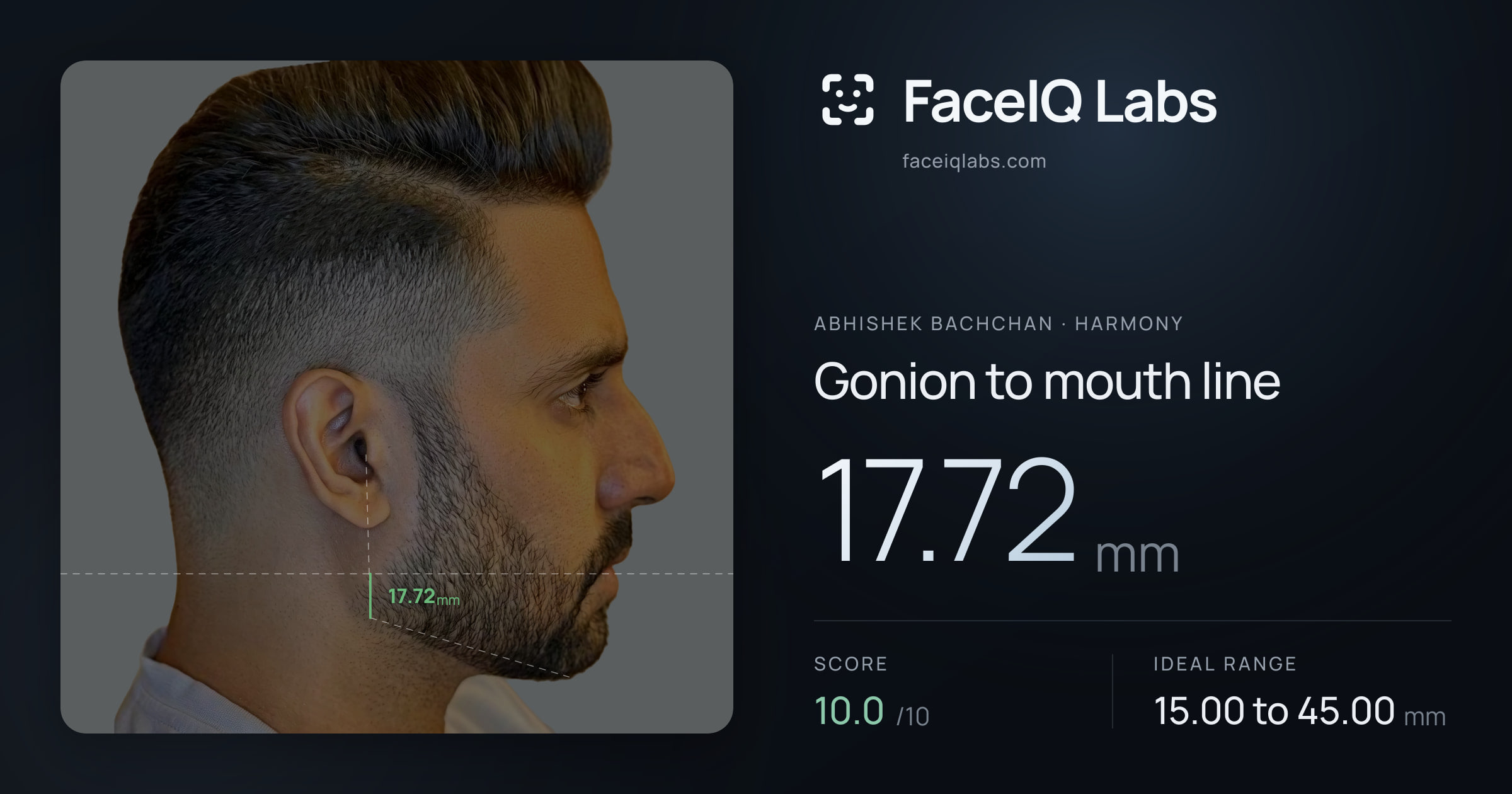 Abhishek Bachchan Gonion to mouth line: 17.72mm, drawn on the photo