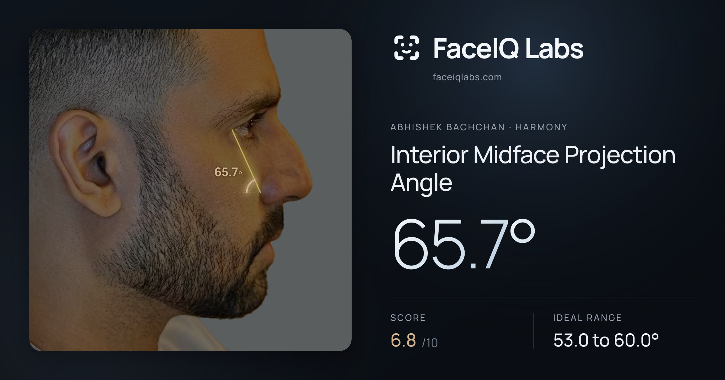 Abhishek Bachchan Interior Midface Projection Angle: 65.7°, drawn on the photo