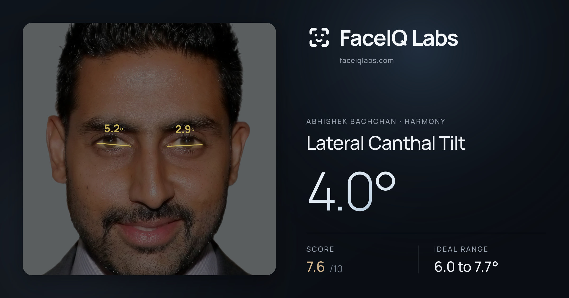 Abhishek Bachchan Lateral Canthal Tilt: 4.0°, drawn on the photo