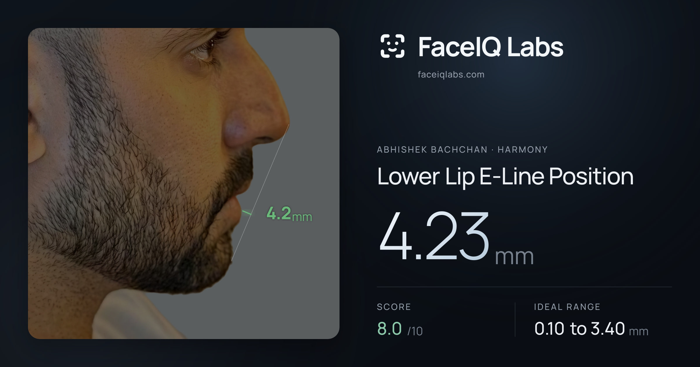 Abhishek Bachchan Lower Lip E-Line Position: 4.23mm, drawn on the photo