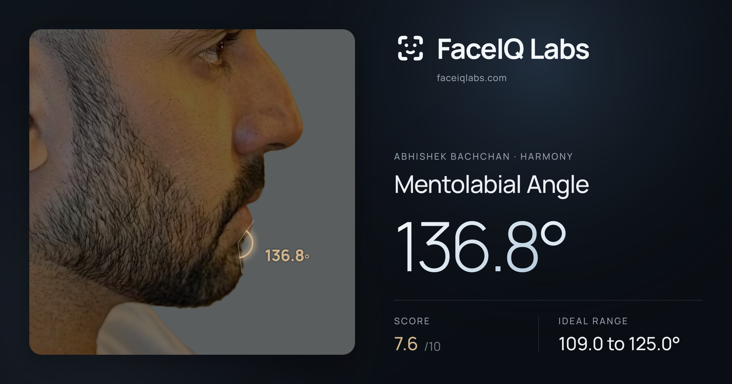 Abhishek Bachchan Mentolabial Angle: 136.8°, drawn on the photo