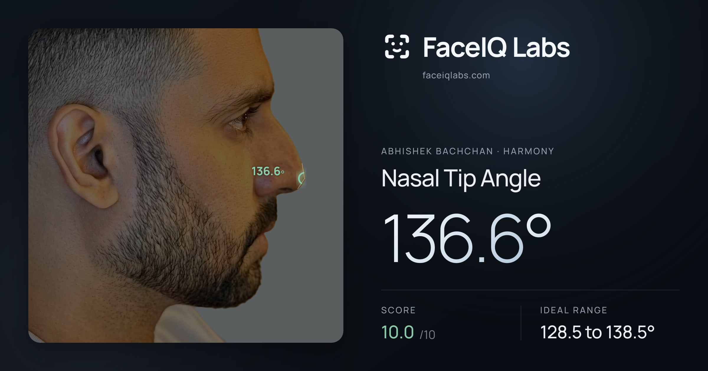 Abhishek Bachchan Nasal Tip Angle: 136.6°, drawn on the photo