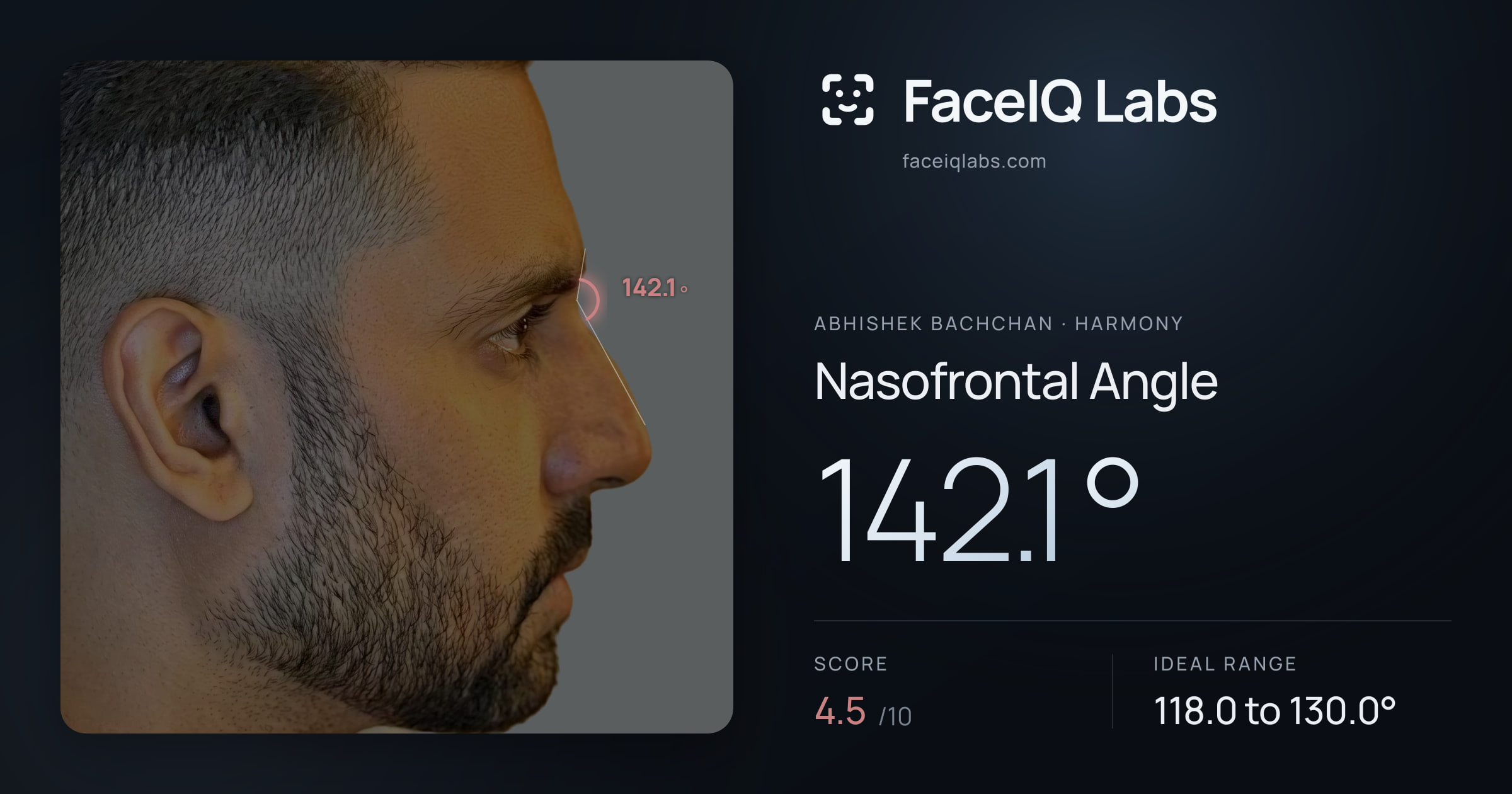 Abhishek Bachchan Nasofrontal Angle: 142.1°, drawn on the photo