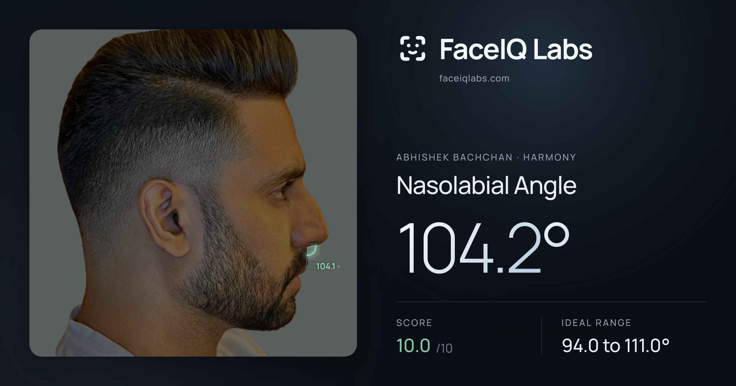 Abhishek Bachchan Nasolabial Angle: 104.2°, drawn on the photo