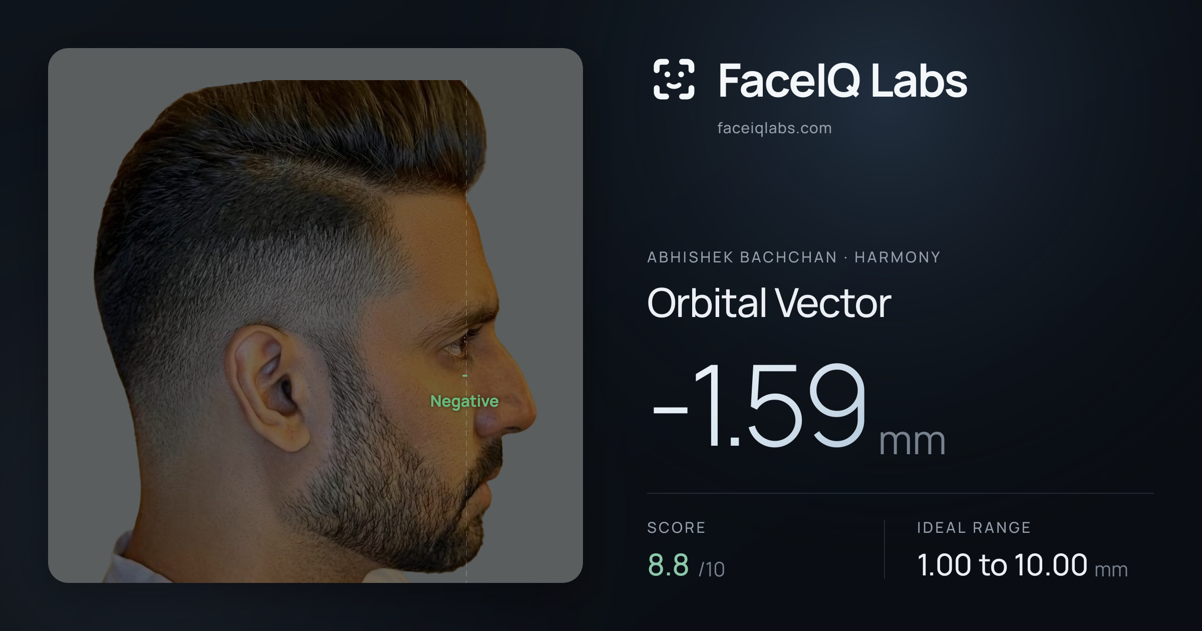 Abhishek Bachchan Orbital Vector: -1.59mm, drawn on the photo