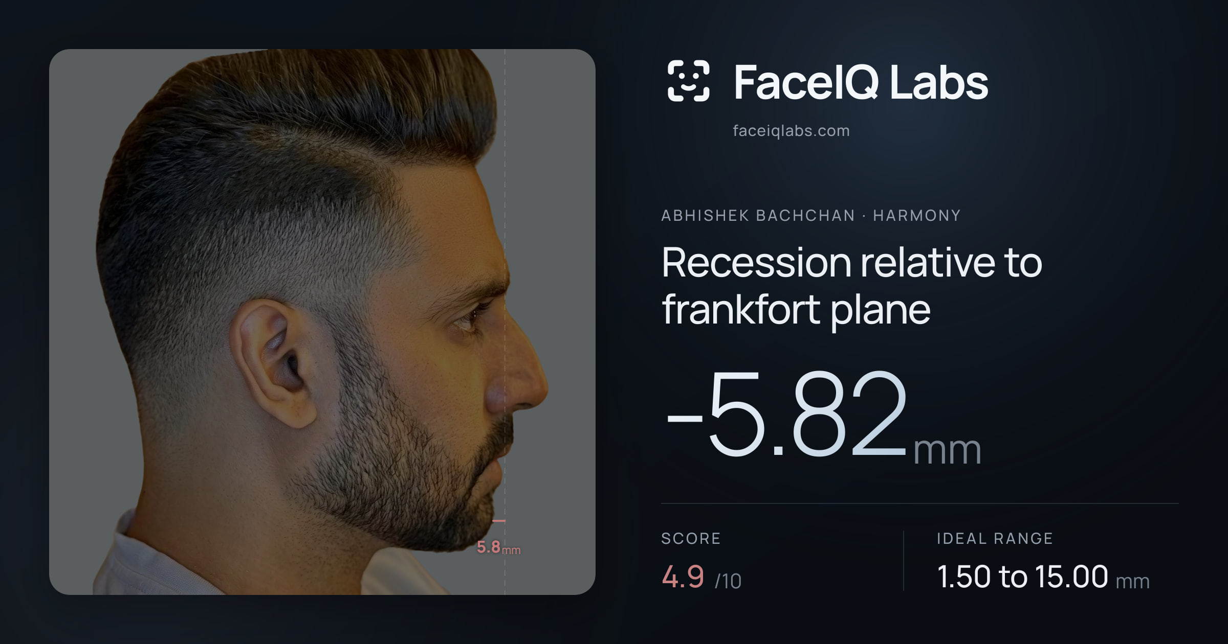 Abhishek Bachchan Recession relative to frankfort plane: -5.82mm, drawn on the photo