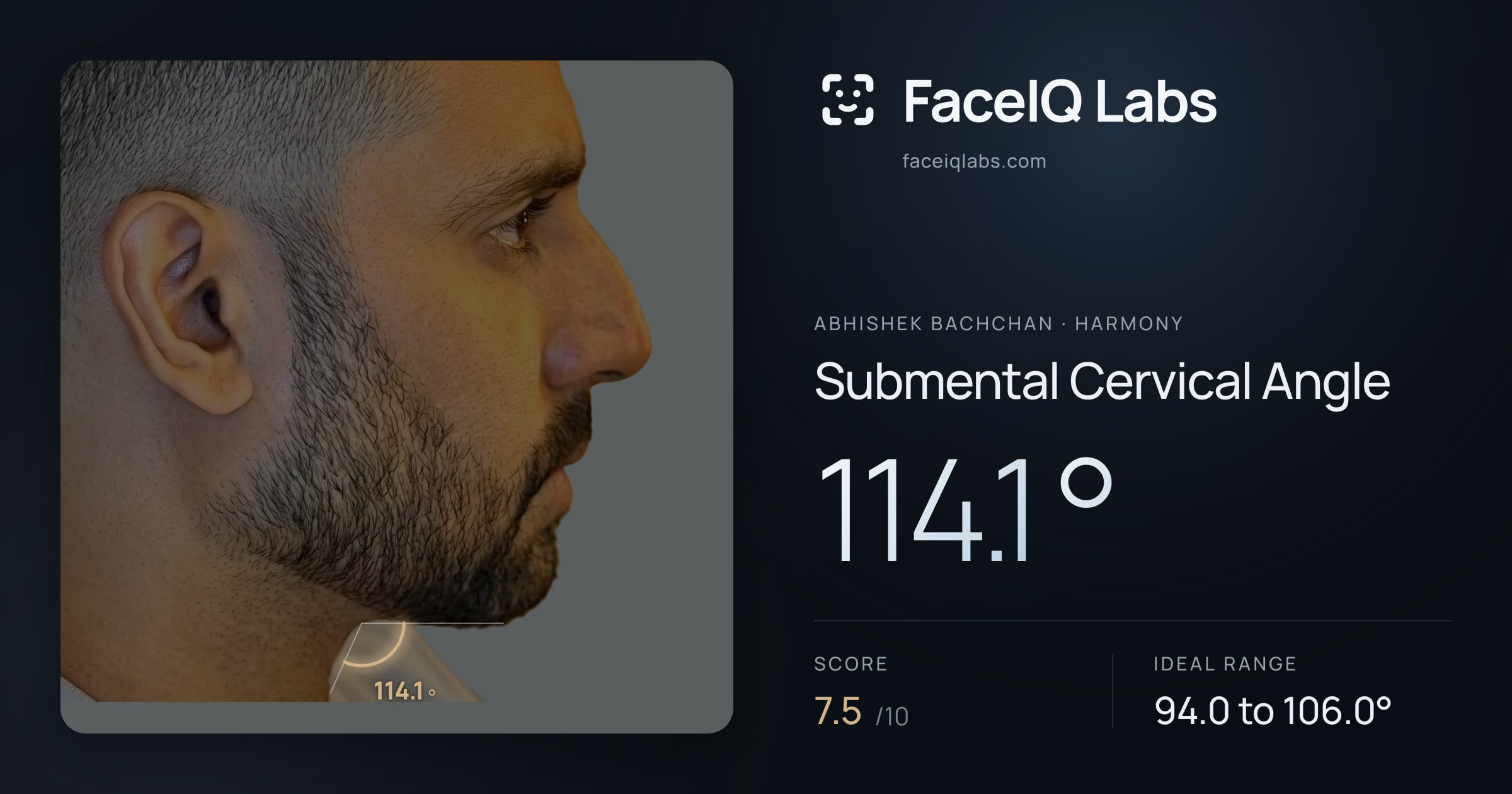 Abhishek Bachchan Submental Cervical Angle: 114.1°, drawn on the photo