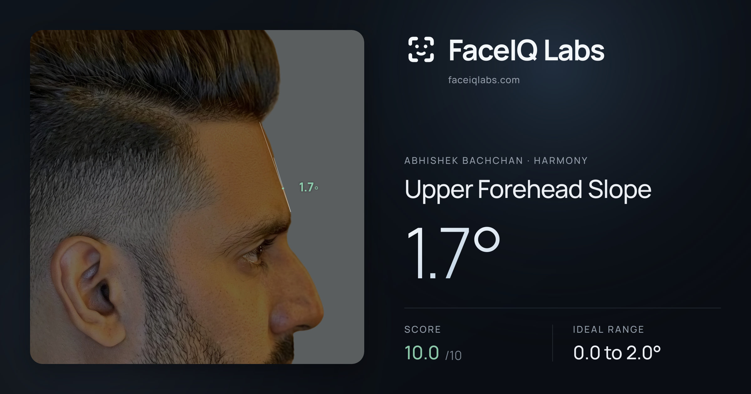 Abhishek Bachchan Upper Forehead Slope: 1.7°, drawn on the photo