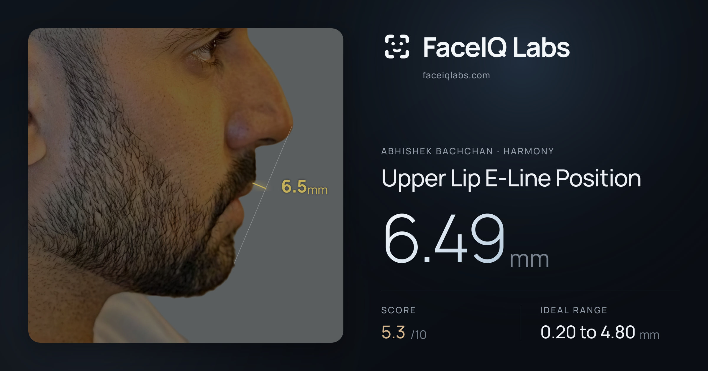 Abhishek Bachchan Upper Lip E-Line Position: 6.49mm, drawn on the photo