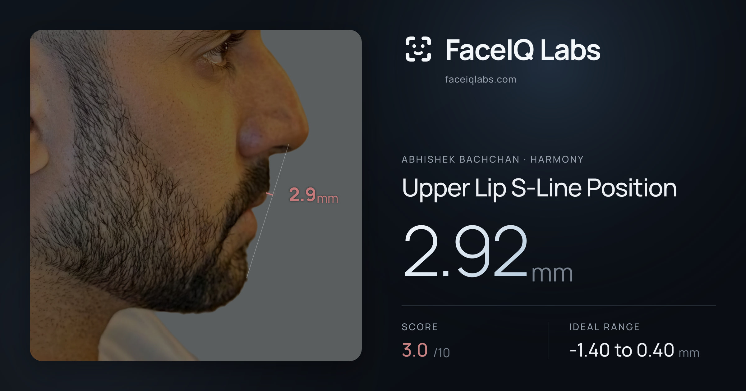 Abhishek Bachchan Upper Lip S-Line Position: 2.92mm, drawn on the photo