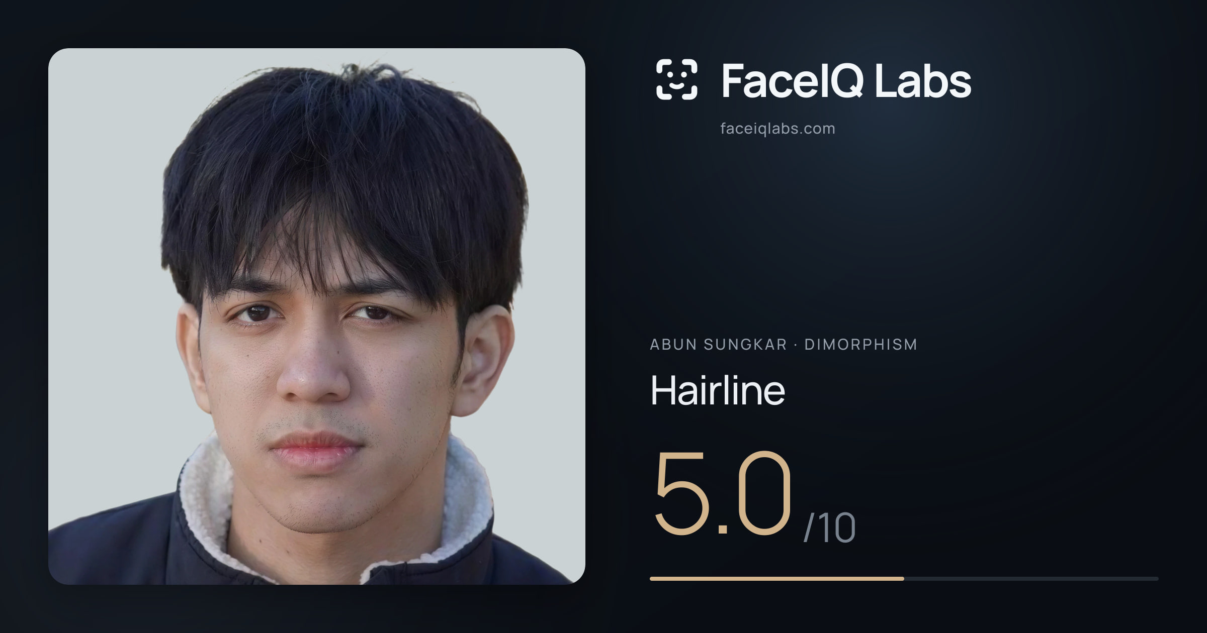 Abun Sungkar Hairline: 5.0/10, drawn on the photo