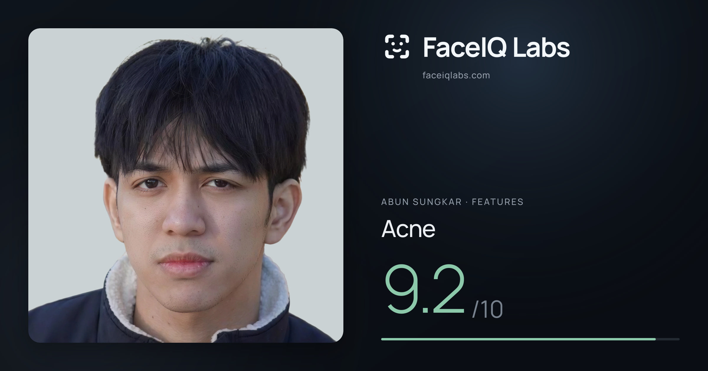 Abun Sungkar Acne: 9.2/10, drawn on the photo