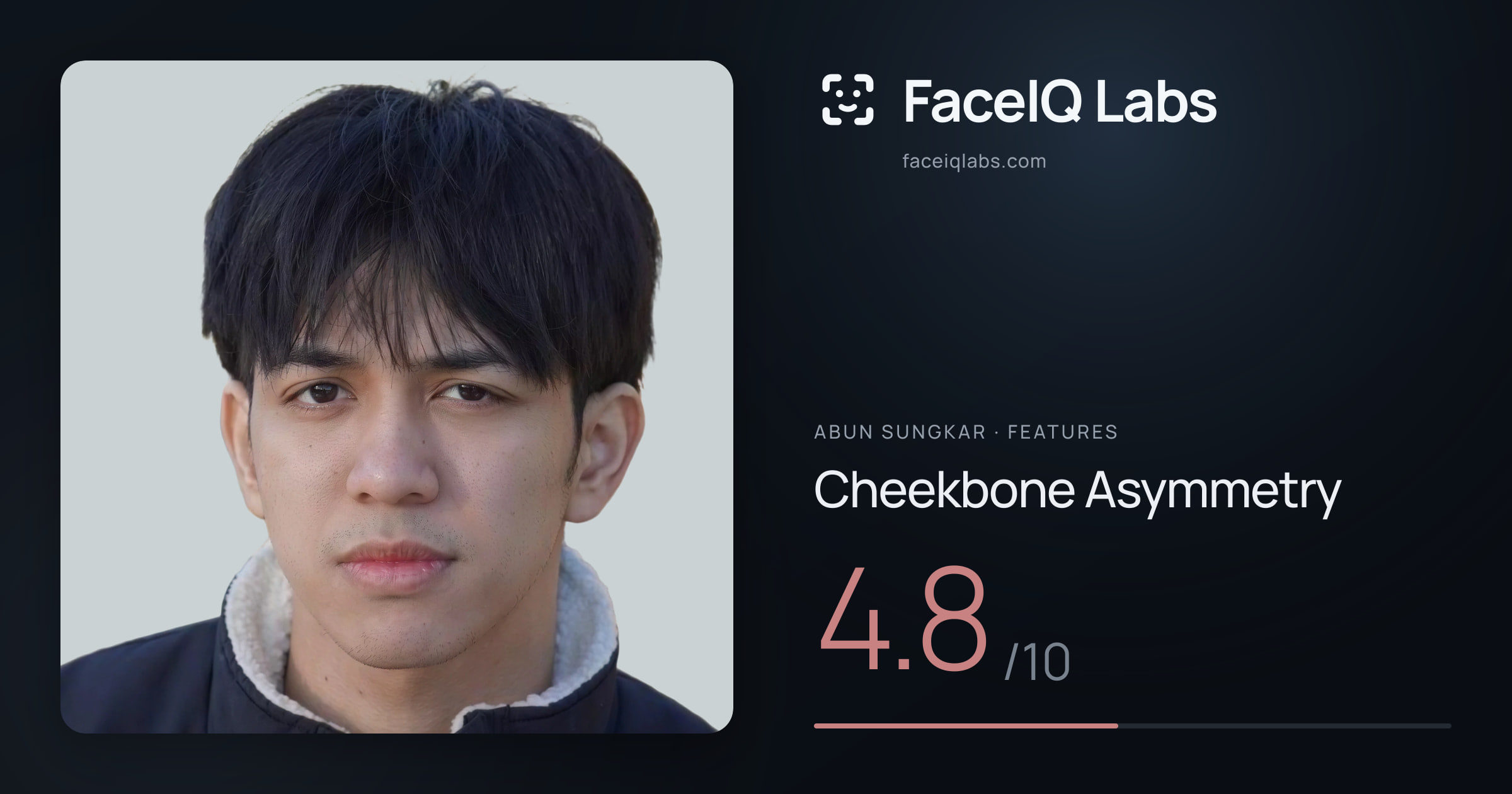 Abun Sungkar Cheekbone Asymmetry: 4.8/10, drawn on the photo