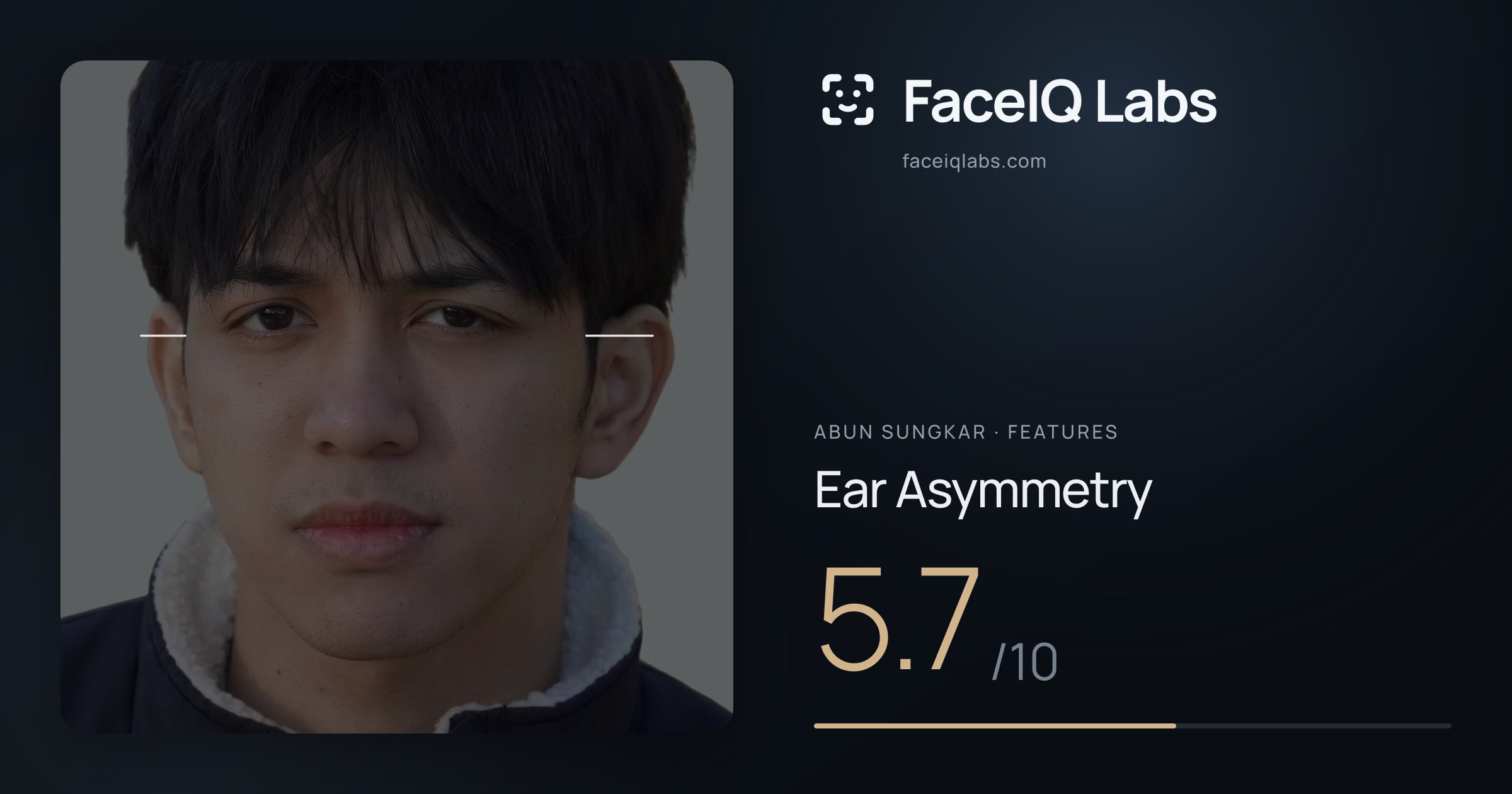 Abun Sungkar Ear Asymmetry: 5.7/10, drawn on the photo