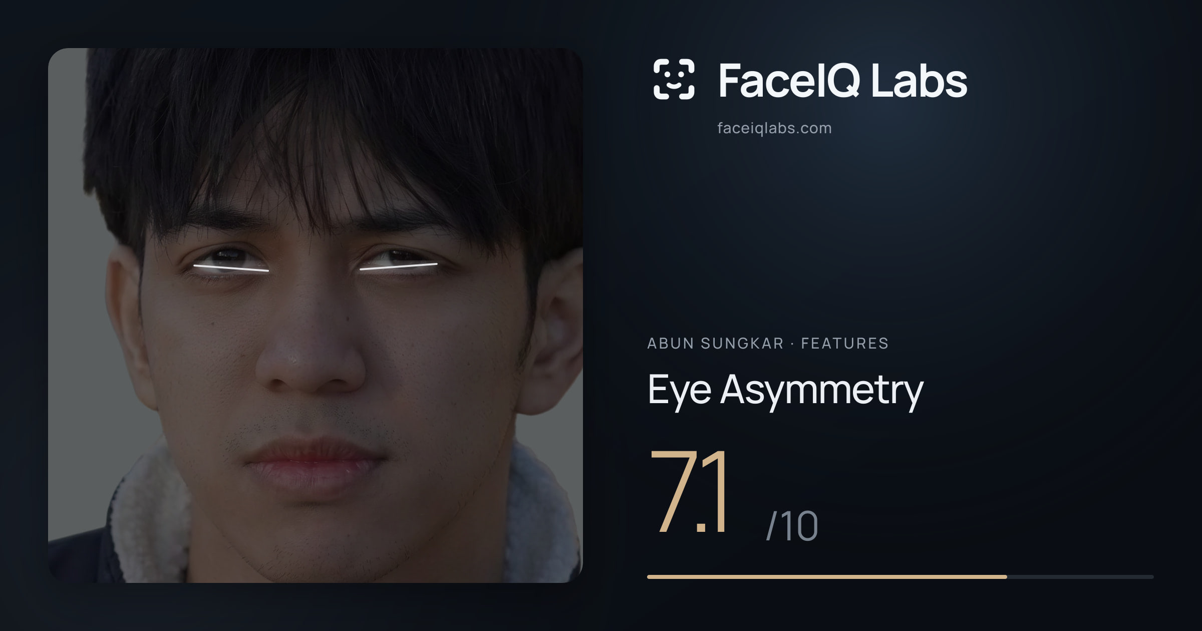 Abun Sungkar Eye Asymmetry: 7.1/10, drawn on the photo