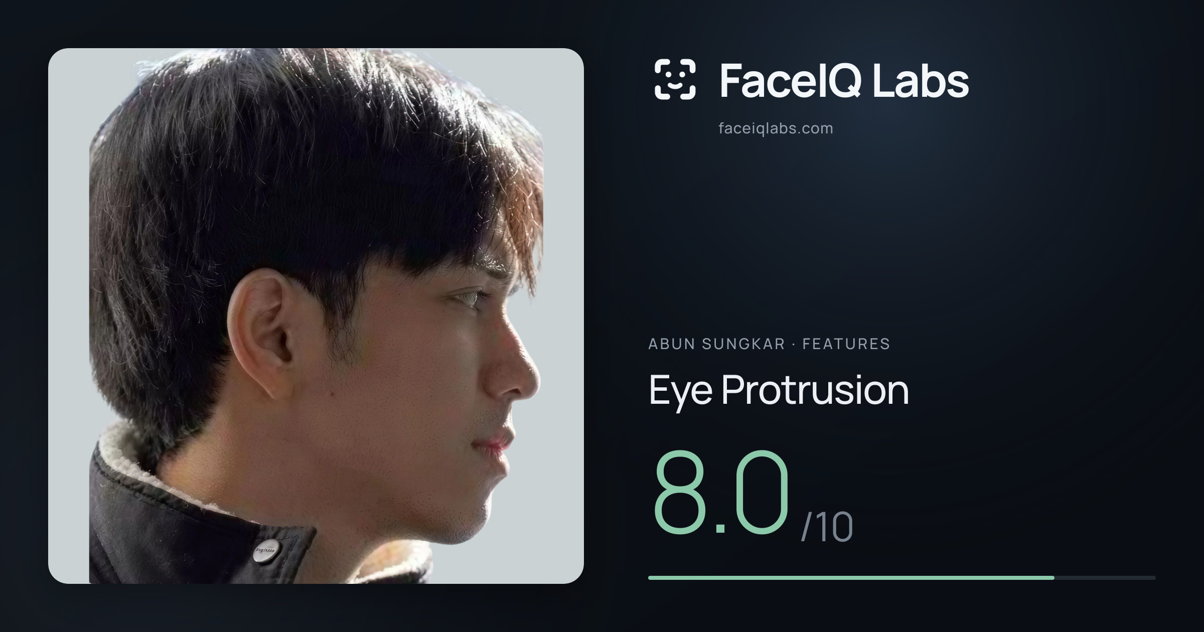 Abun Sungkar Eye Protrusion: 8.0/10, drawn on the photo