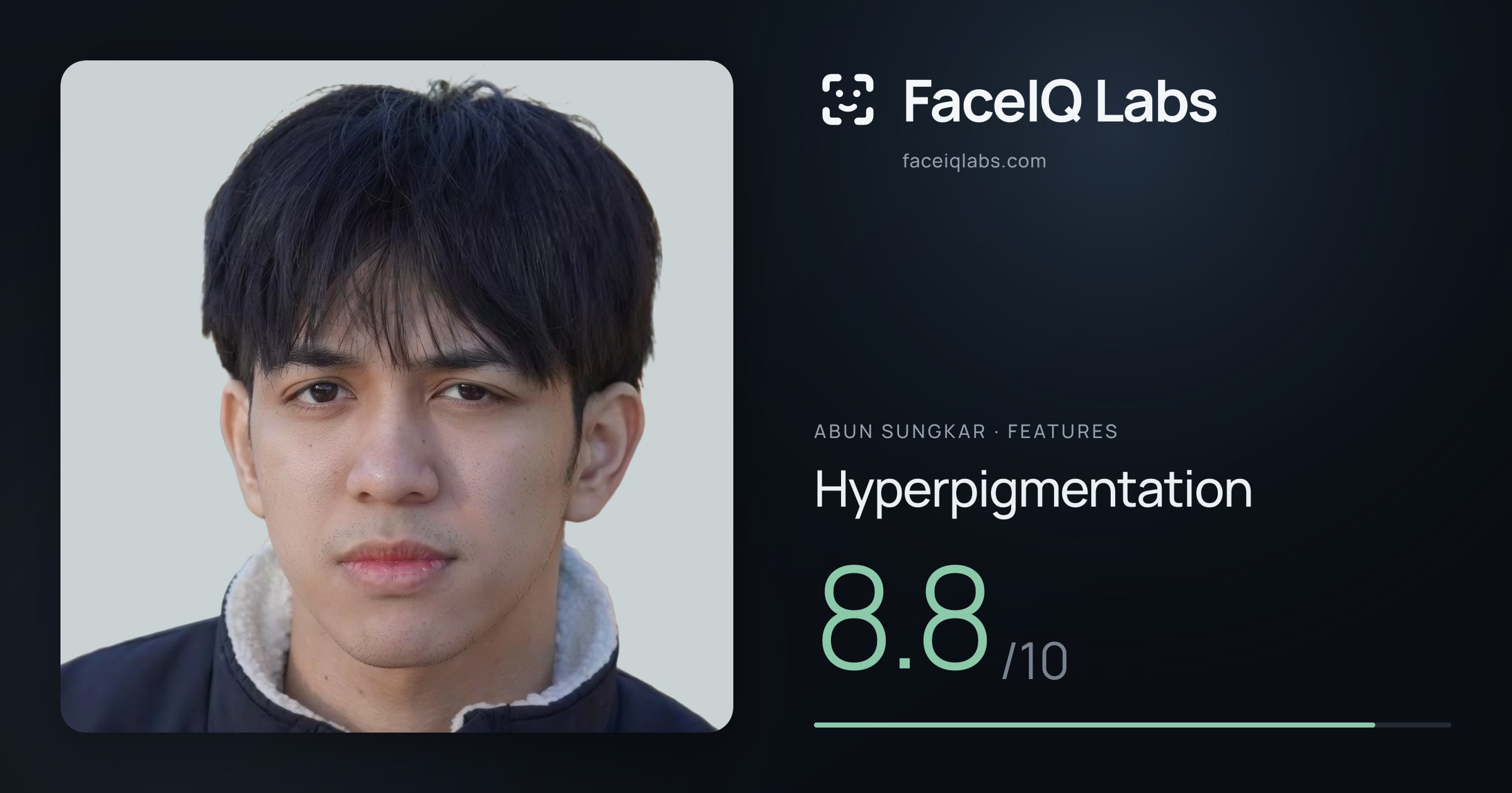 Abun Sungkar Hyperpigmentation: 8.8/10, drawn on the photo
