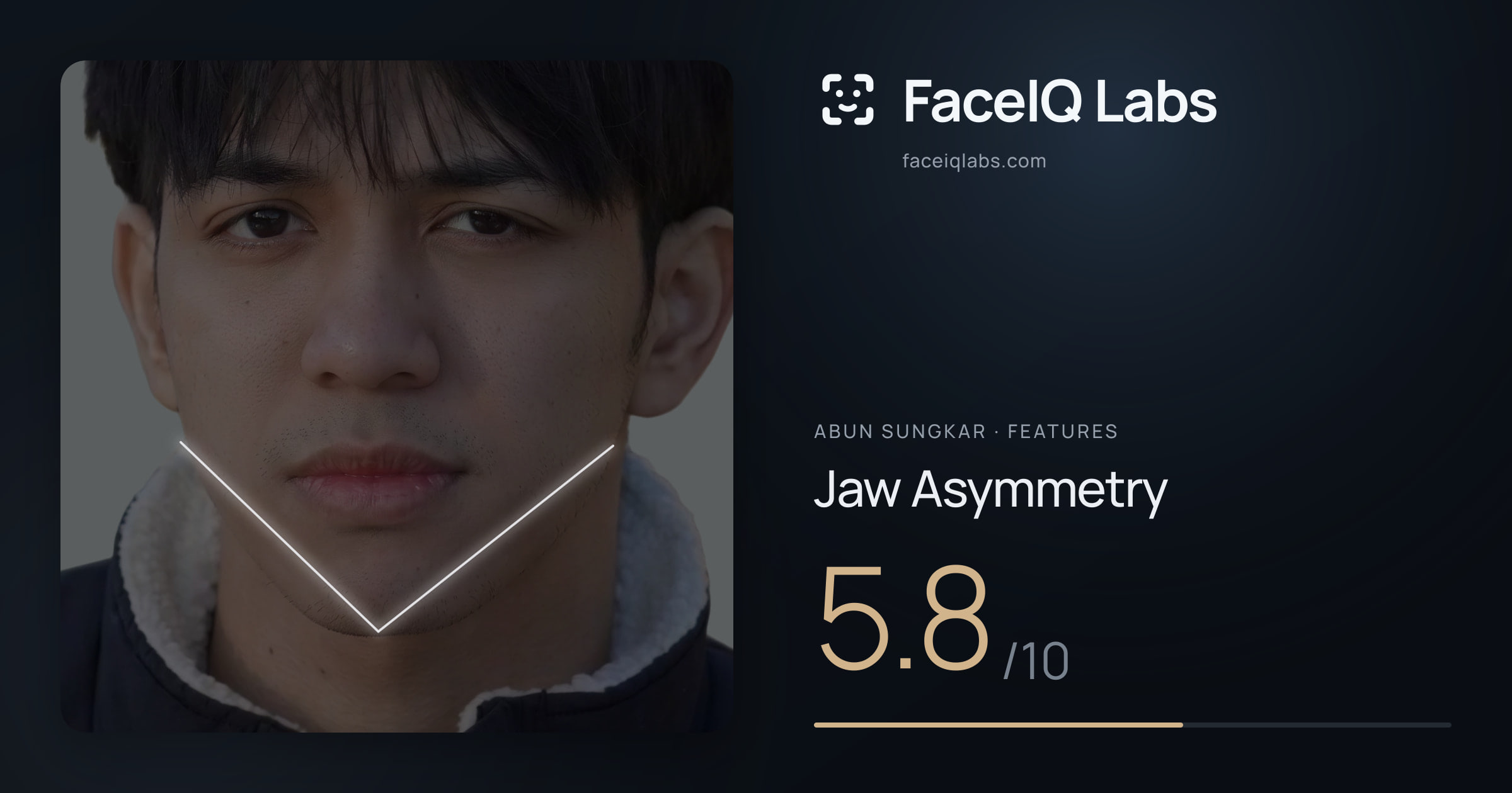 Abun Sungkar Jaw Asymmetry: 5.8/10, drawn on the photo