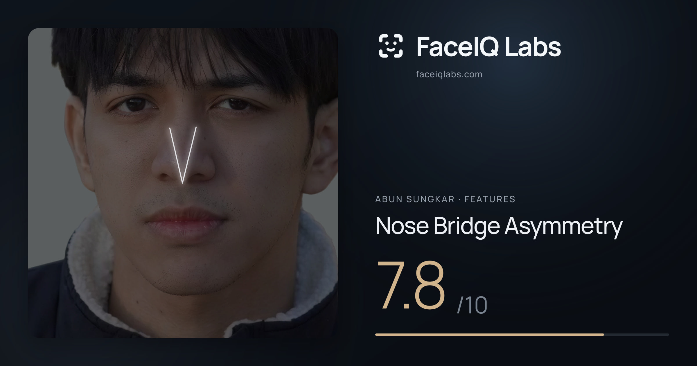 Abun Sungkar Nose Bridge Asymmetry: 7.8/10, drawn on the photo