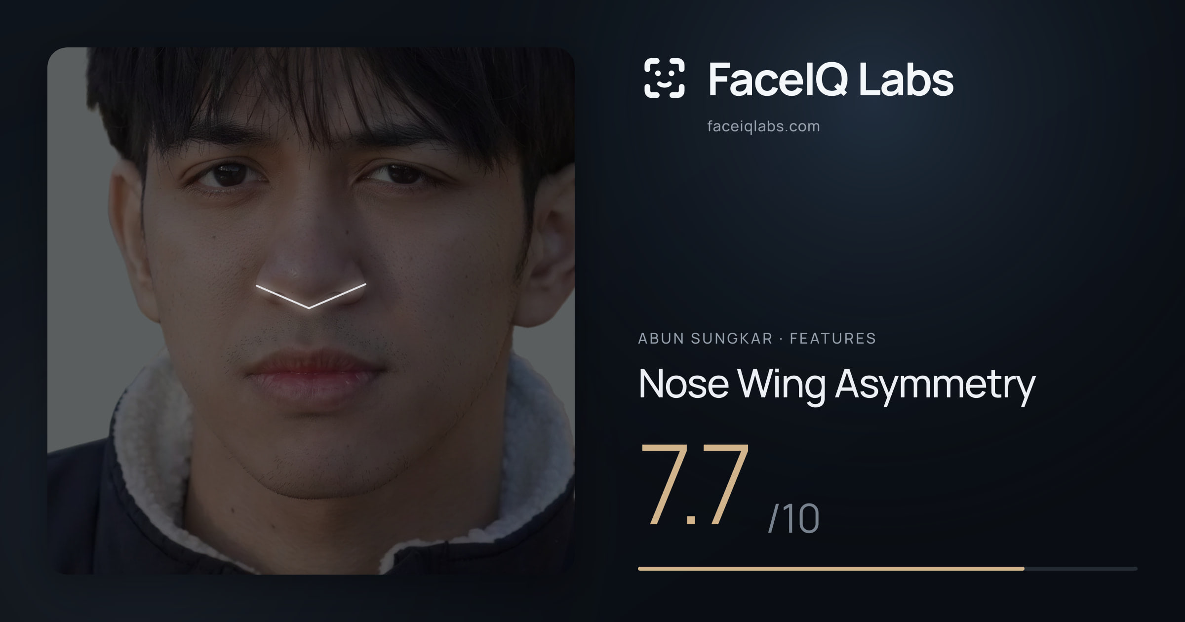 Abun Sungkar Nose Wing Asymmetry: 7.7/10, drawn on the photo