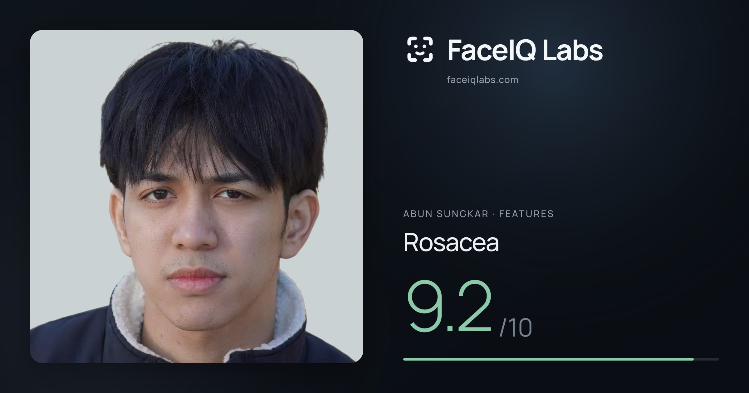 Abun Sungkar Rosacea: 9.2/10, drawn on the photo