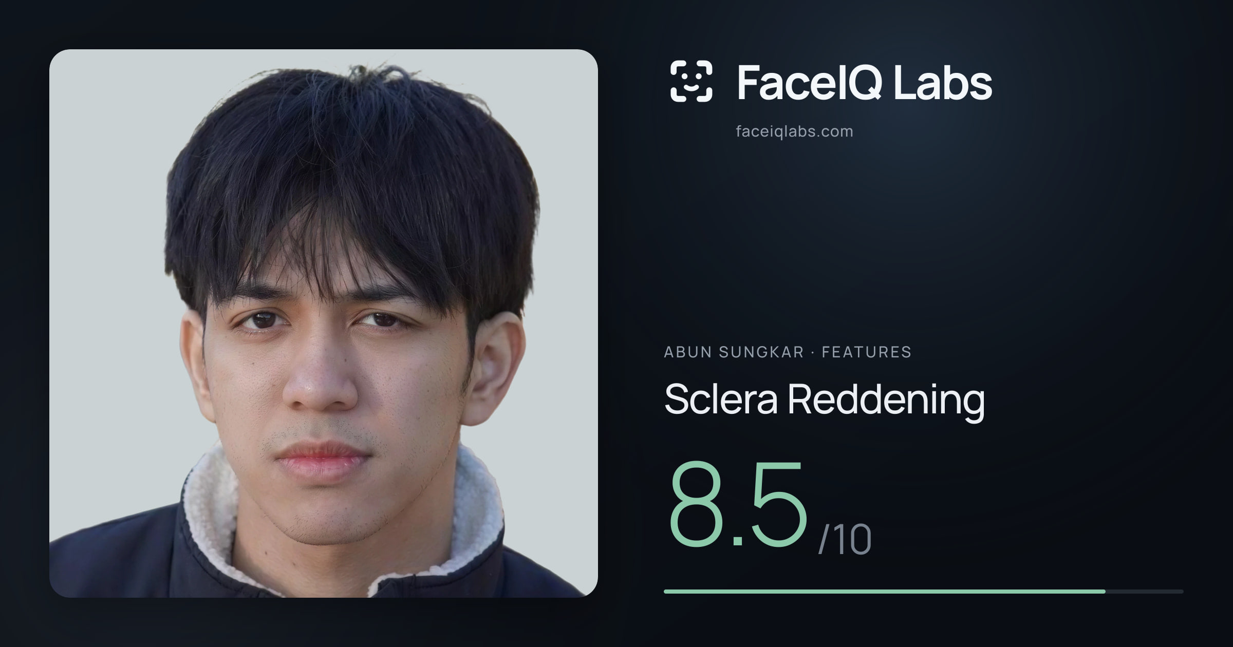 Abun Sungkar Sclera Reddening: 8.5/10, drawn on the photo