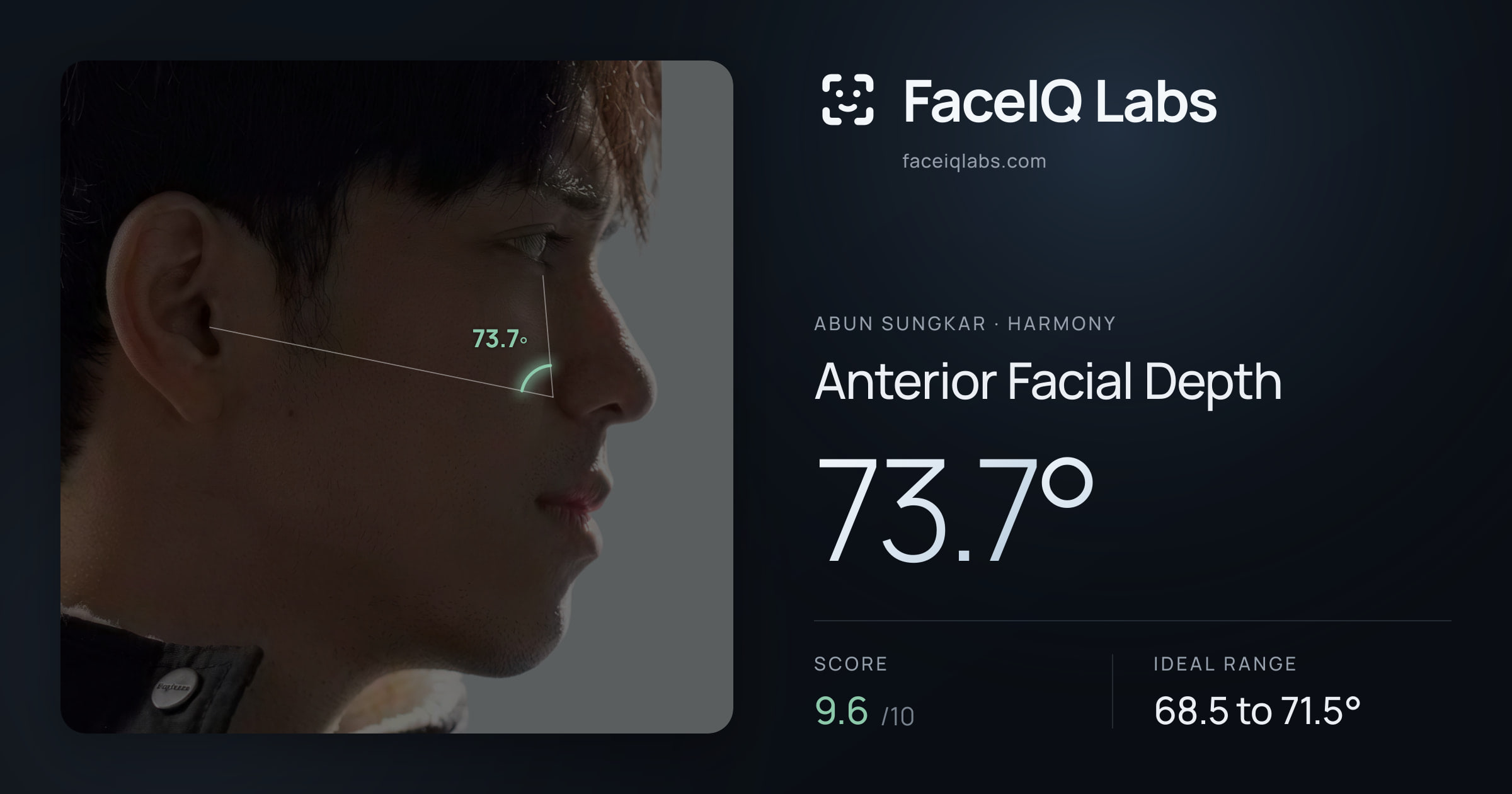Abun Sungkar Anterior Facial Depth: 73.7°, drawn on the photo