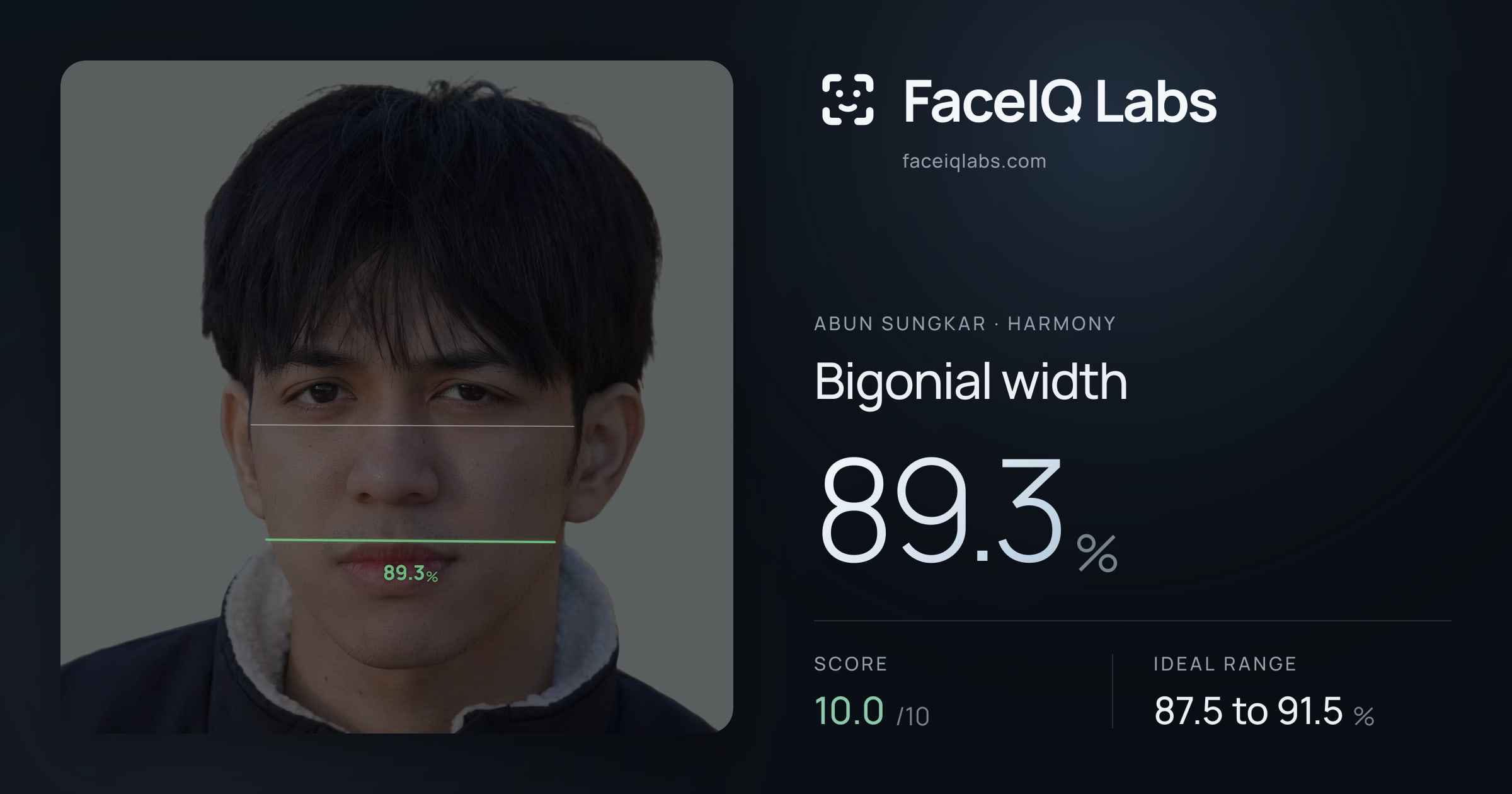 Abun Sungkar Bigonial width: 89.3%, drawn on the photo