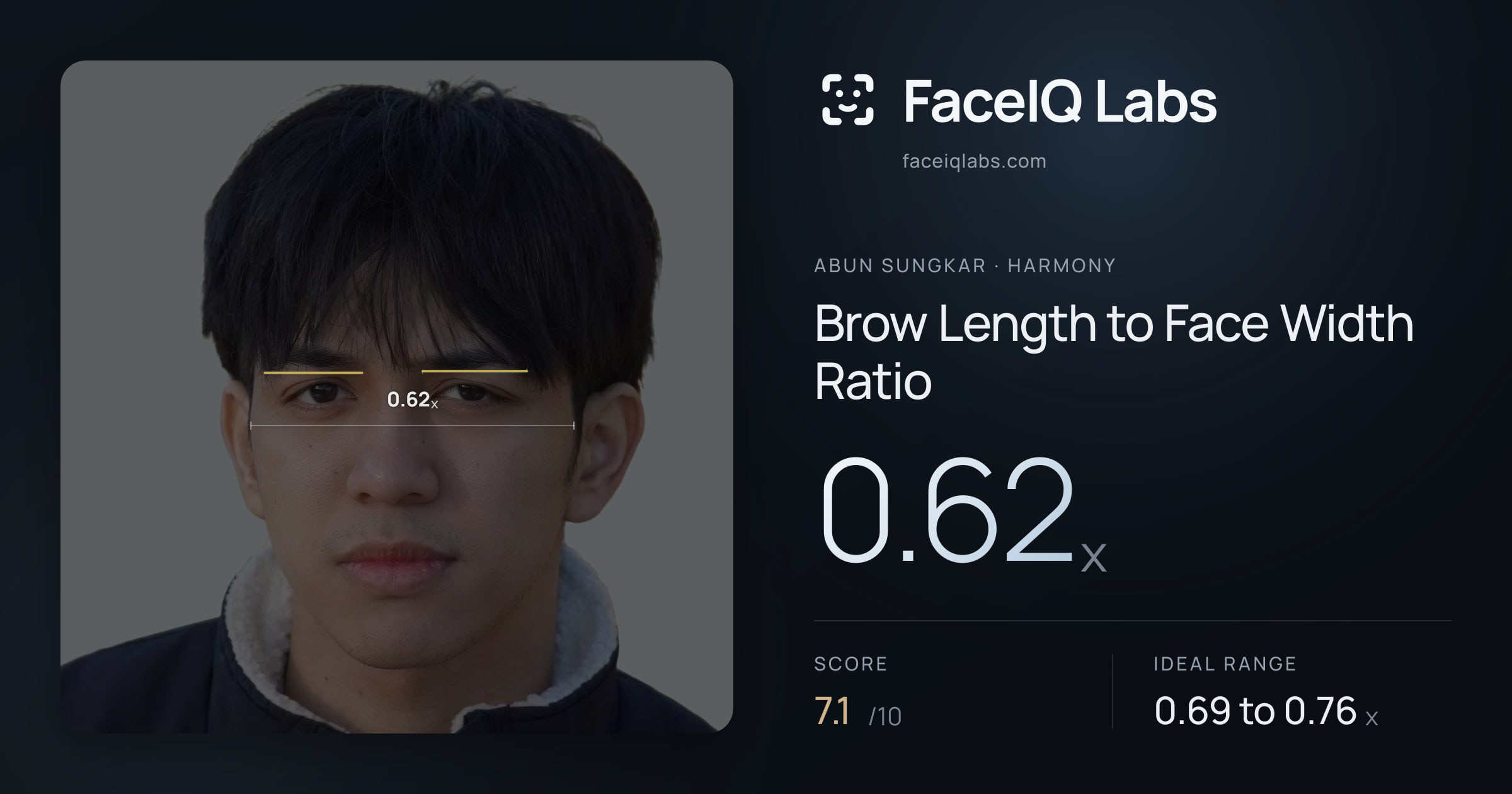 Abun Sungkar Brow Length to Face Width Ratio: 0.62x, drawn on the photo