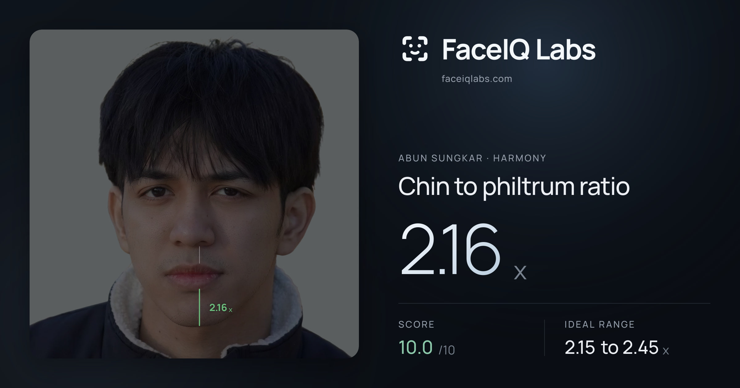 Abun Sungkar Chin to philtrum ratio: 2.16x, drawn on the photo